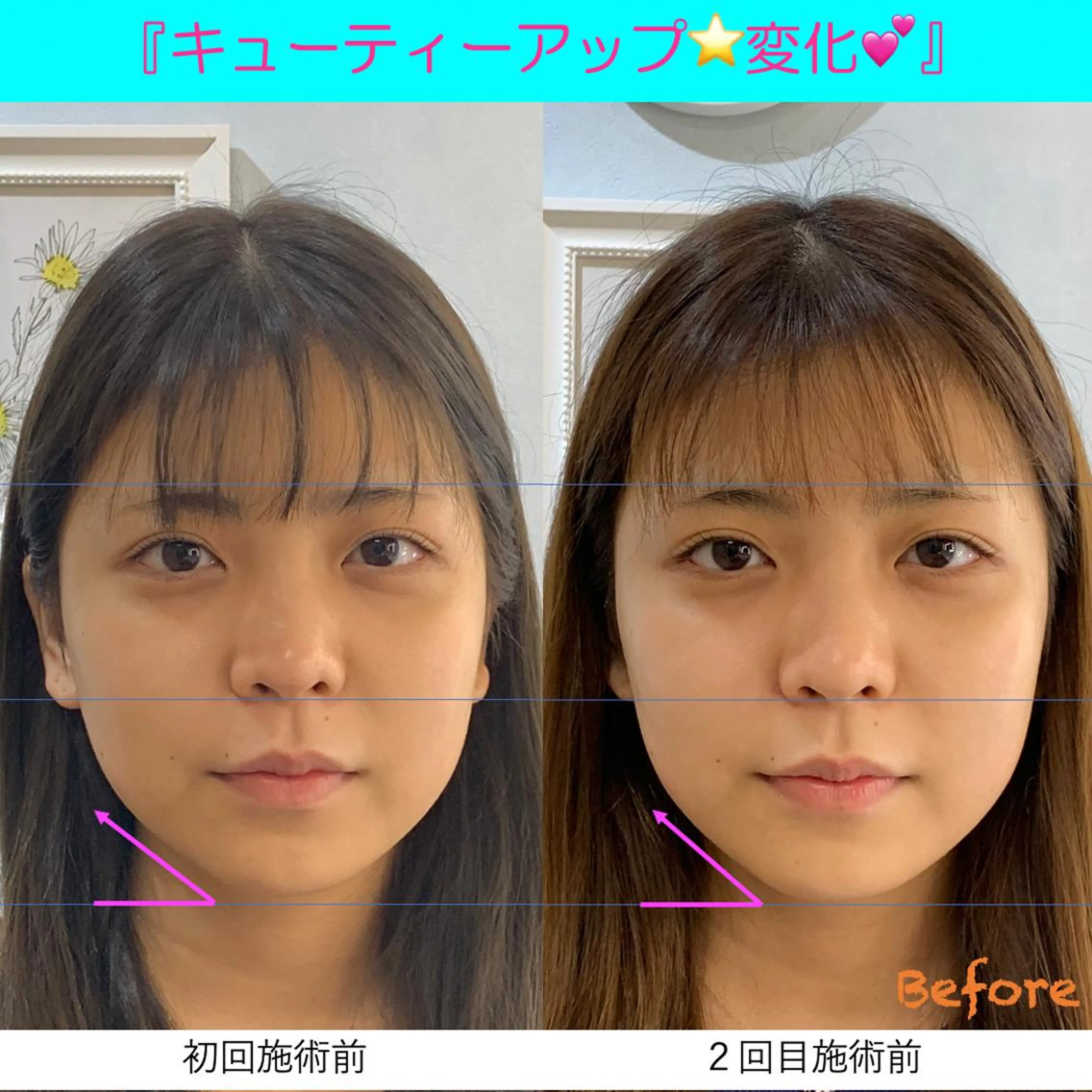 小顔美肌&痩身ｻﾛﾝ My Timeのエステ・リラクイメージ