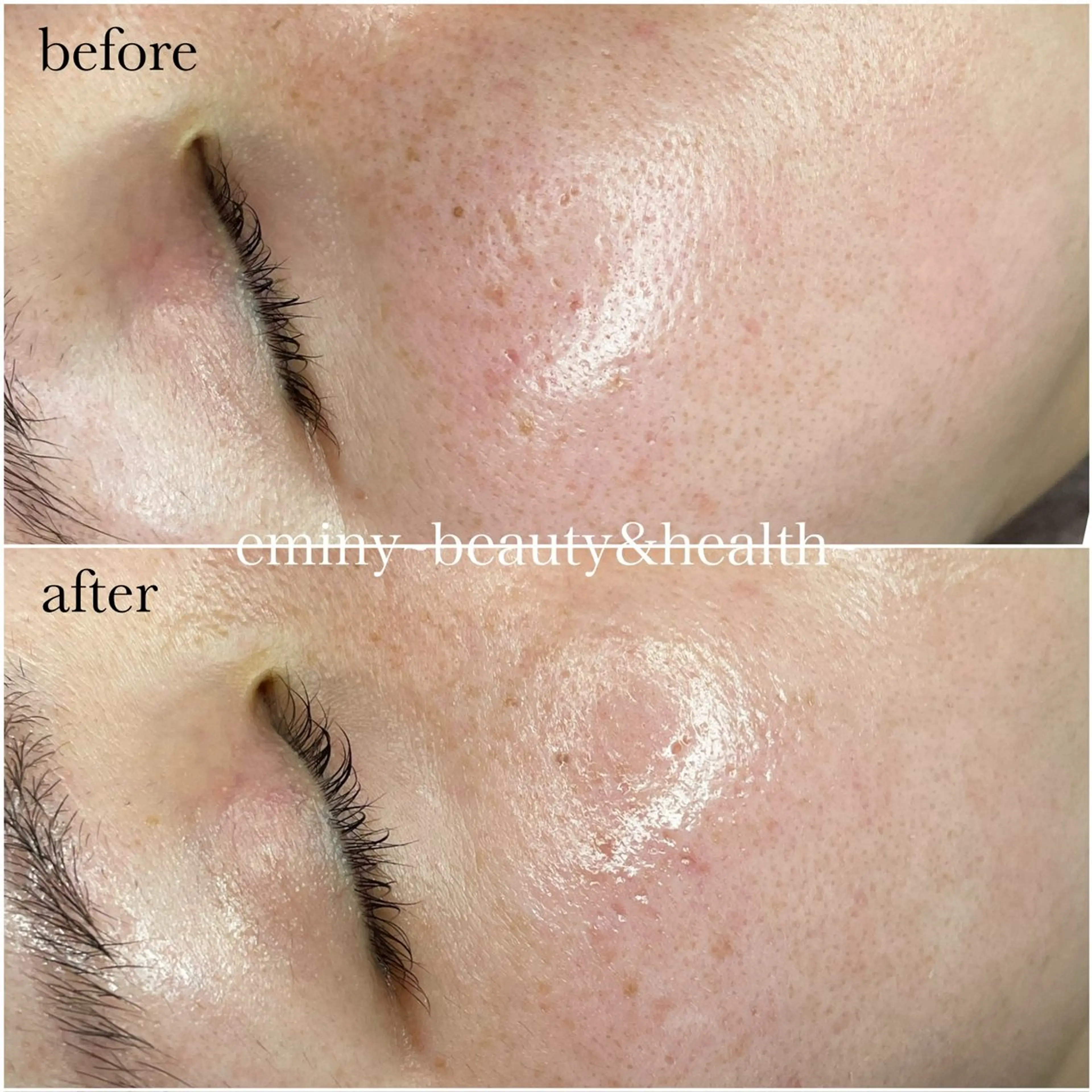 艶肌Wax®︎ (美肌づくりwax)の写真