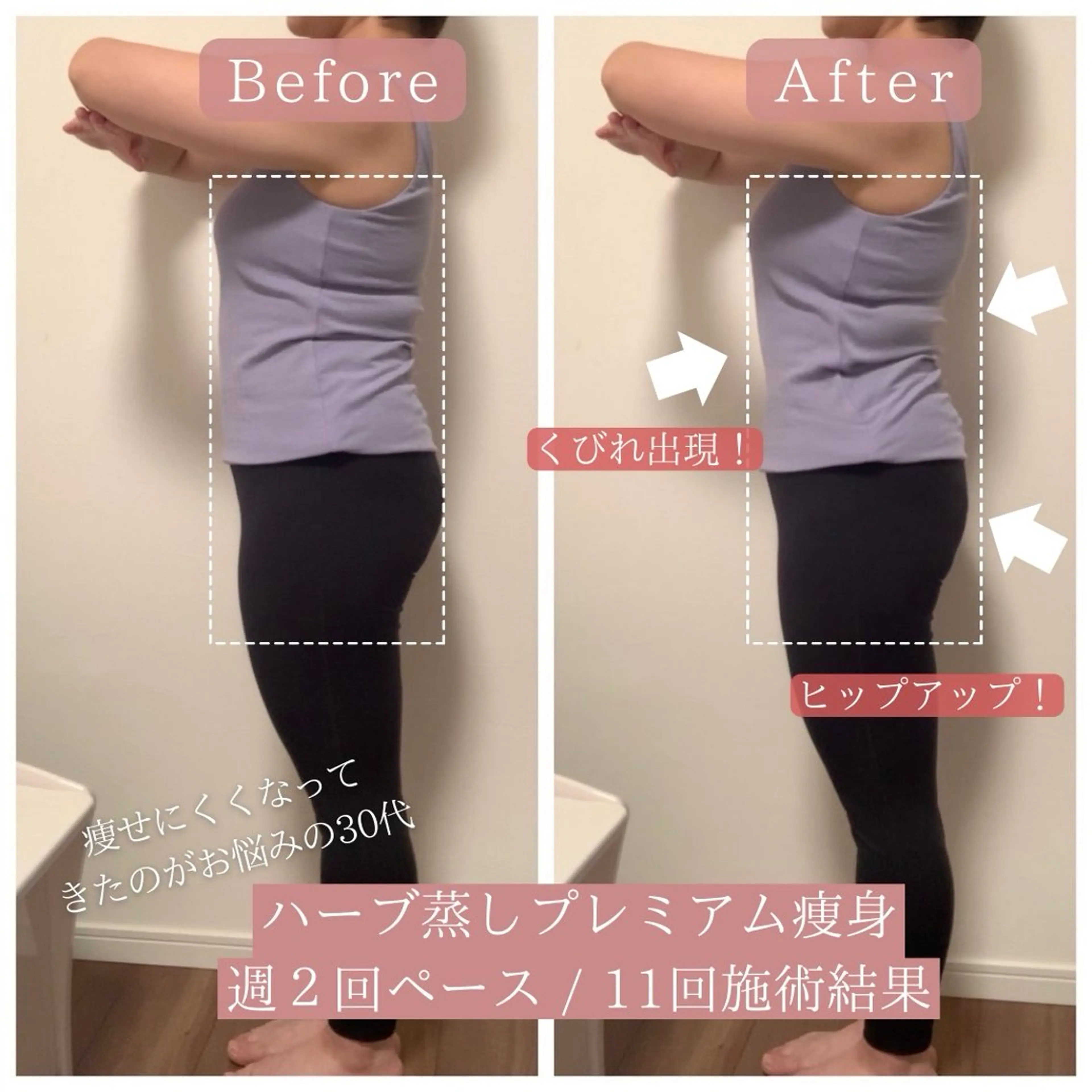 ハーブ蒸し小顔矯正 サロンLinoのエステ・リラクイメージ