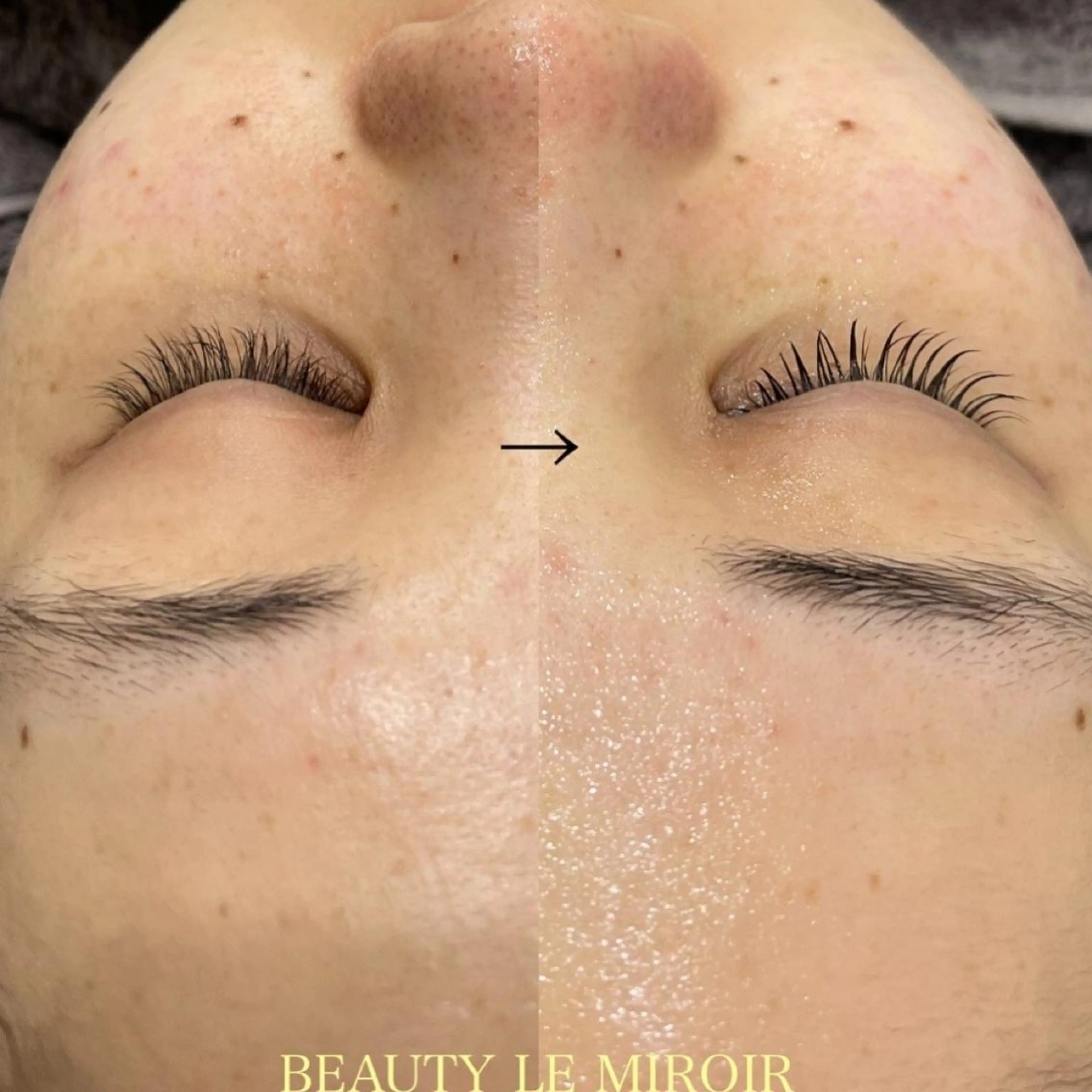 ビューティー ミロワールのエステ・リラクイメージ