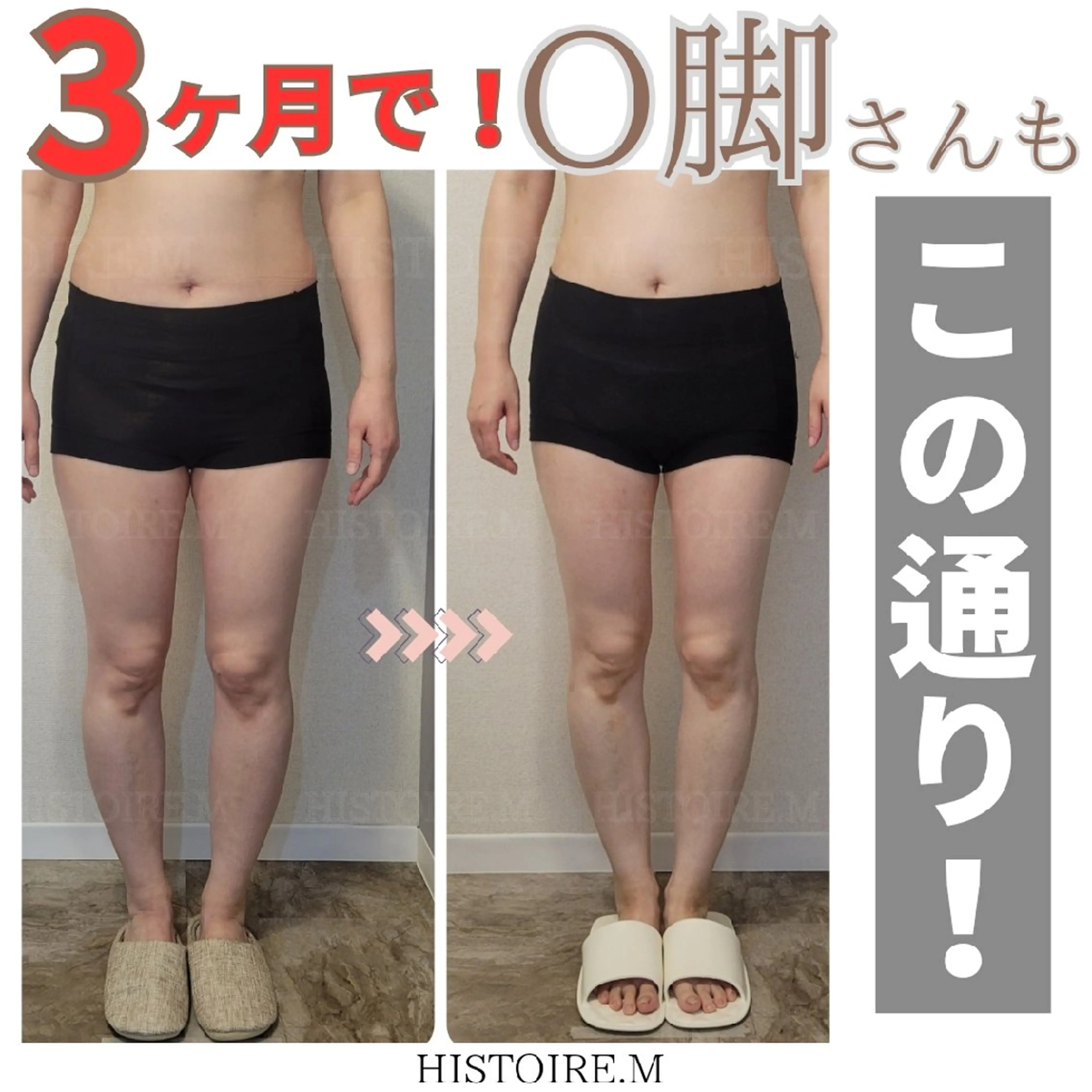 ダイエット/体質改善 /筋膜リリース専門店のエステ・リラクイメージ