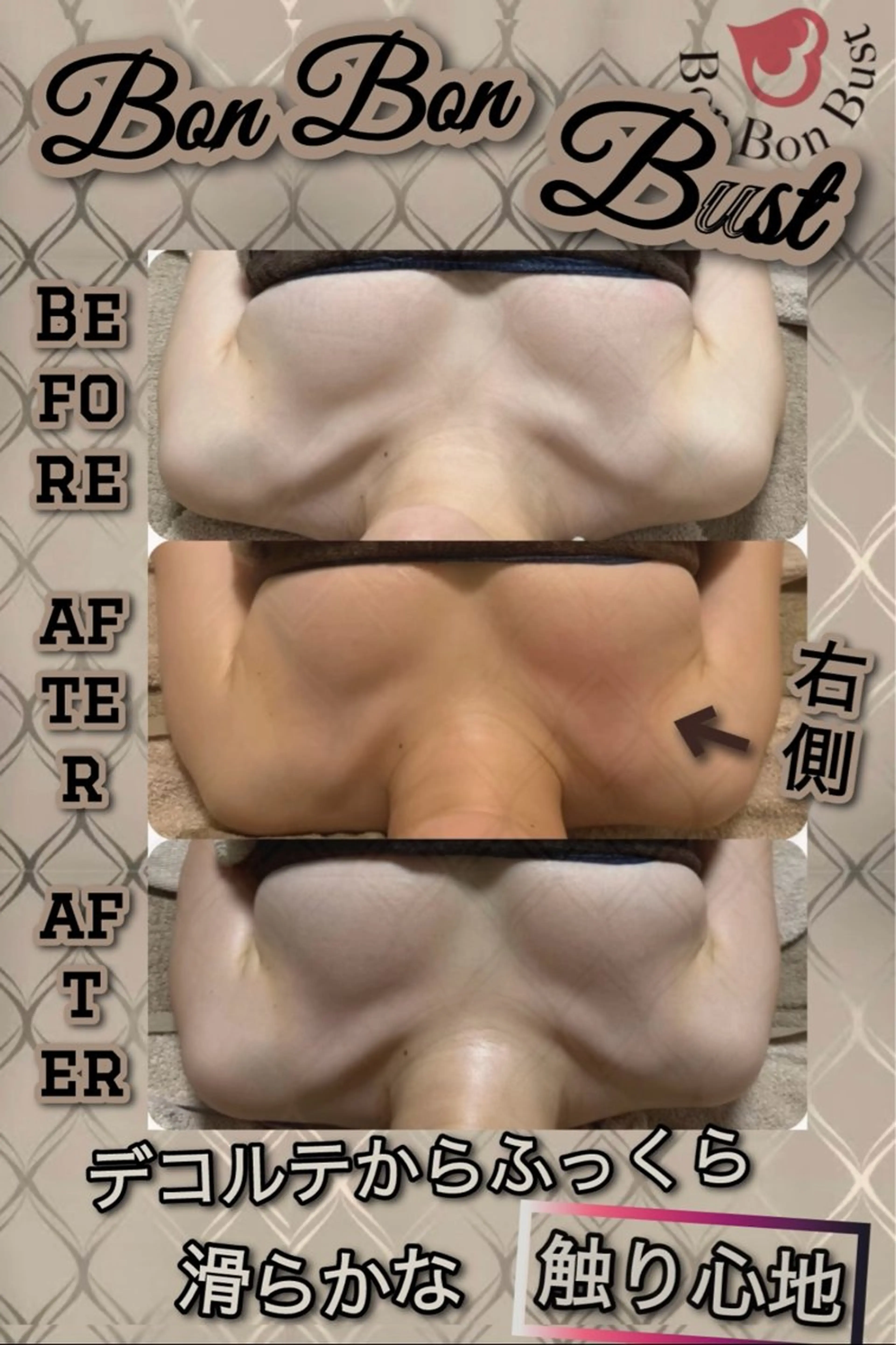 エステ ヴィーナス ビューティーのエステ・リラクイメージ