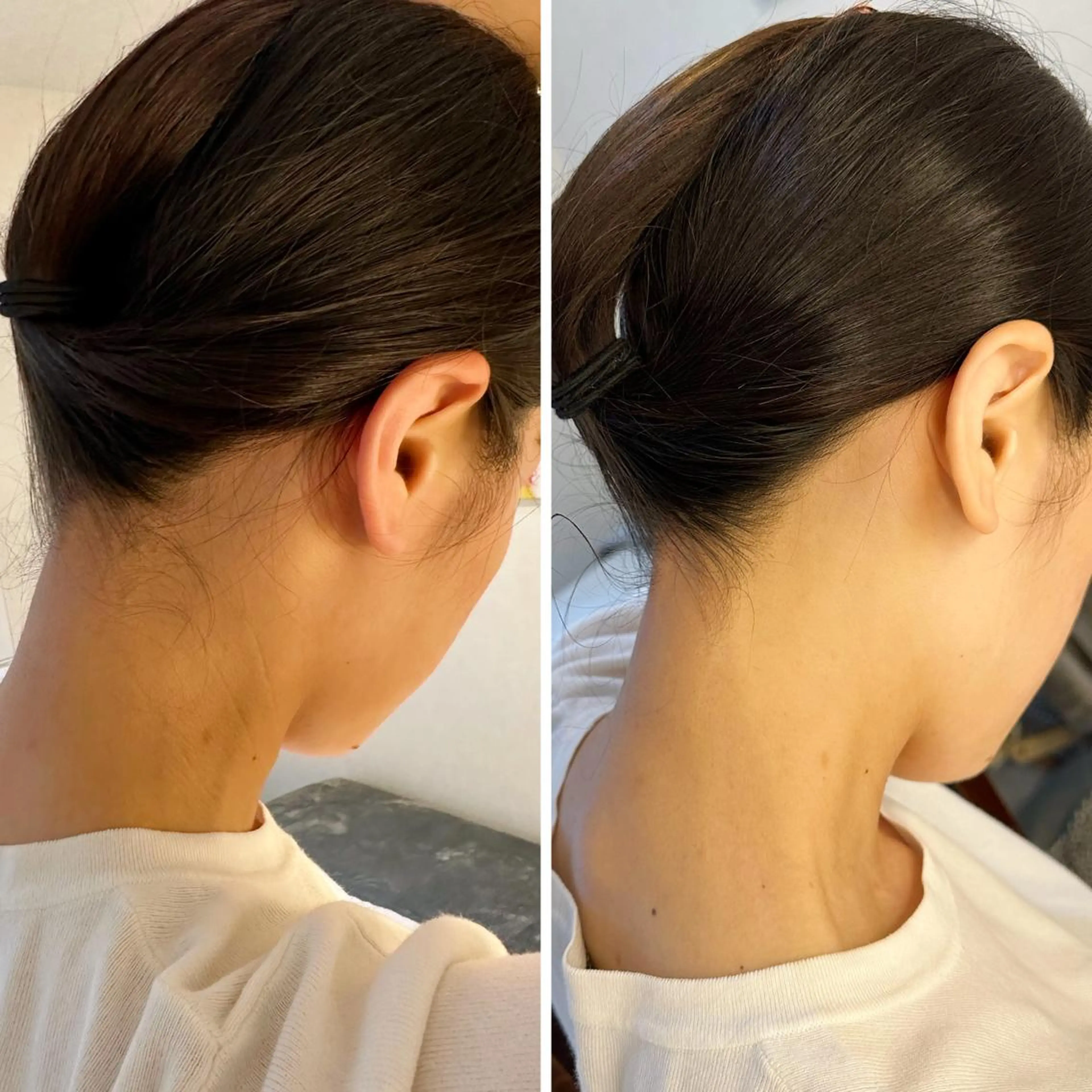 脱毛 うなじ脱毛/美肌脱毛 LABELのエステ・リラクイメージ