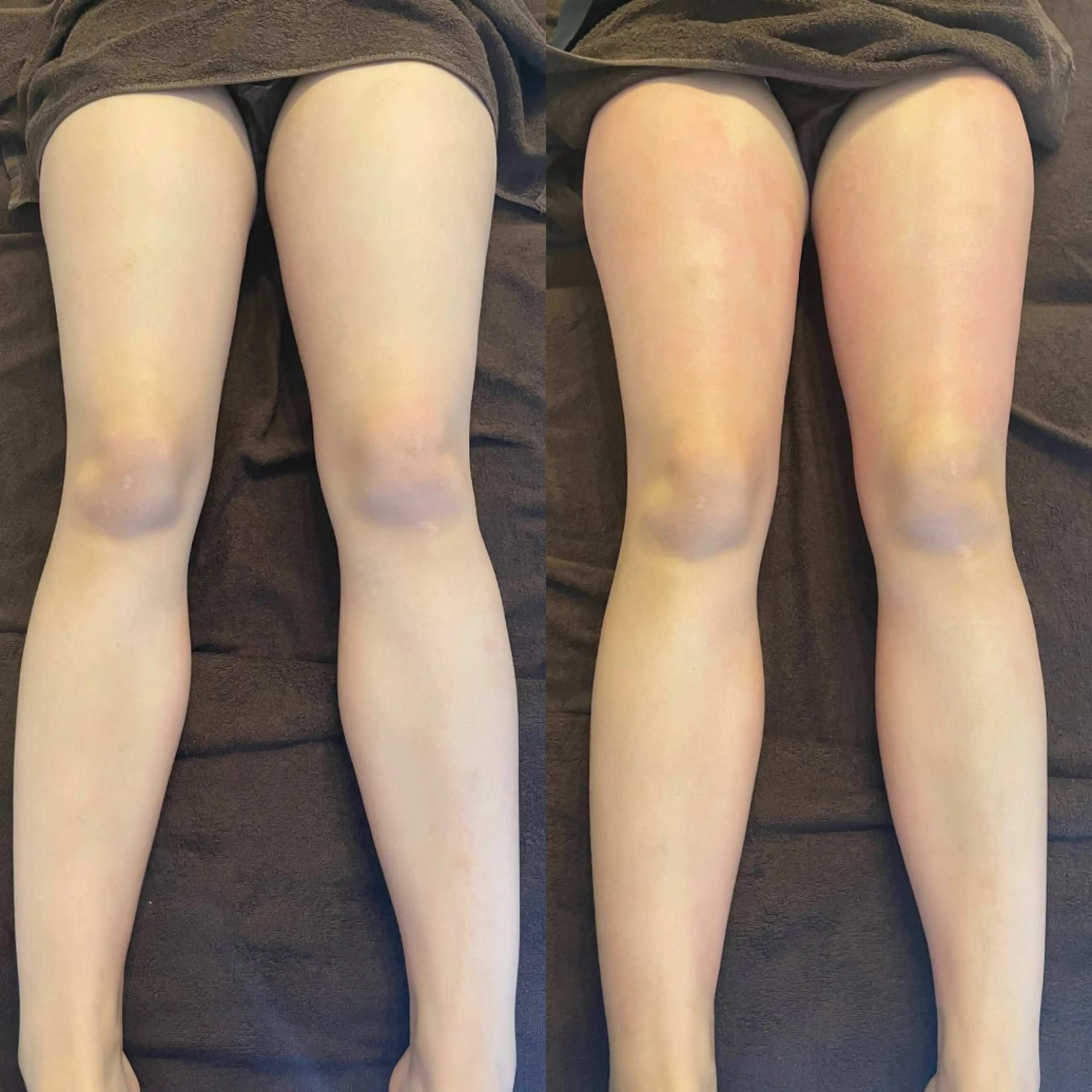 エステ 夕希 毛穴と脱毛特化サロンのエステ・リラクイメージ