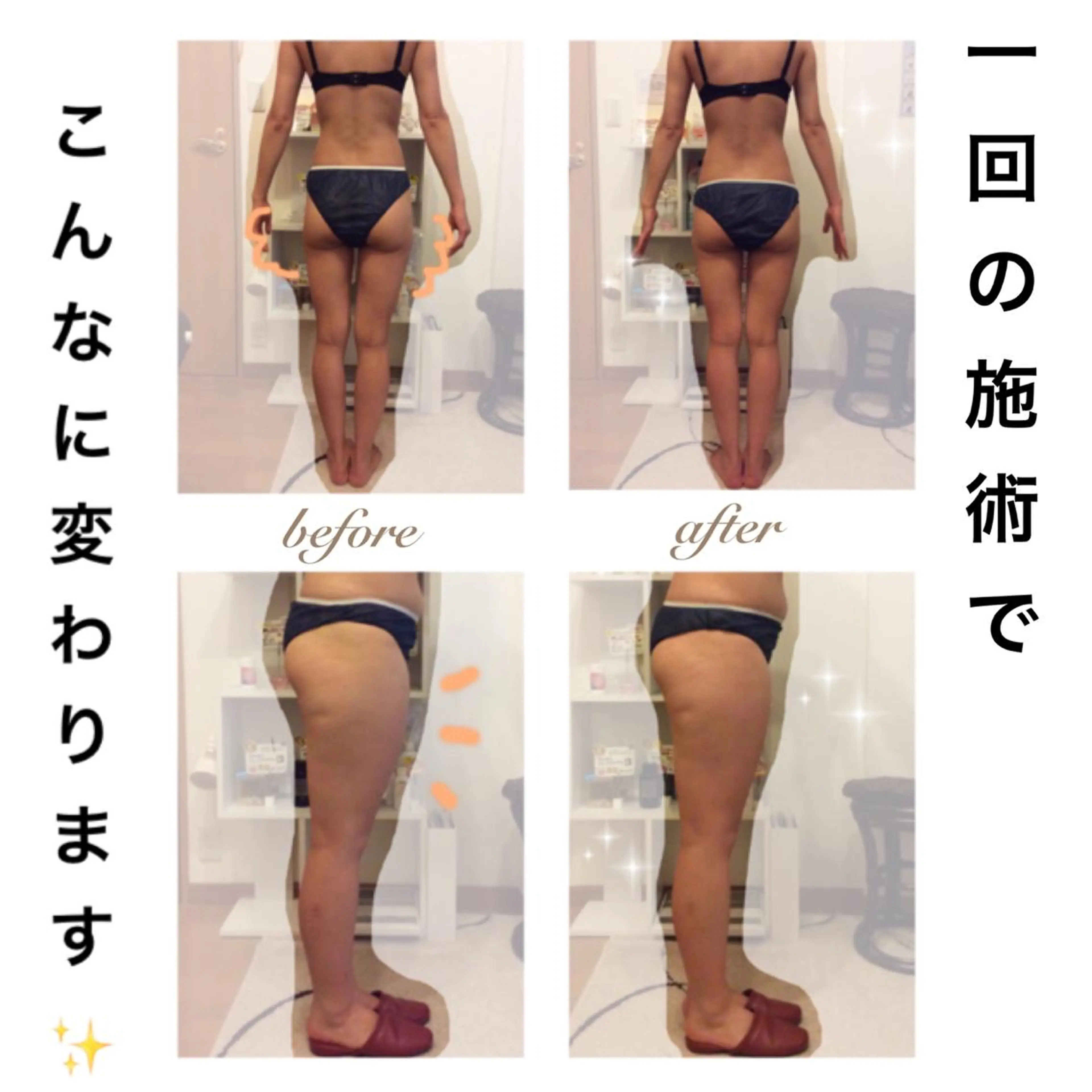 エステ リラク ダイエット・美肌ケア fleurのエステ・リラクイメージ