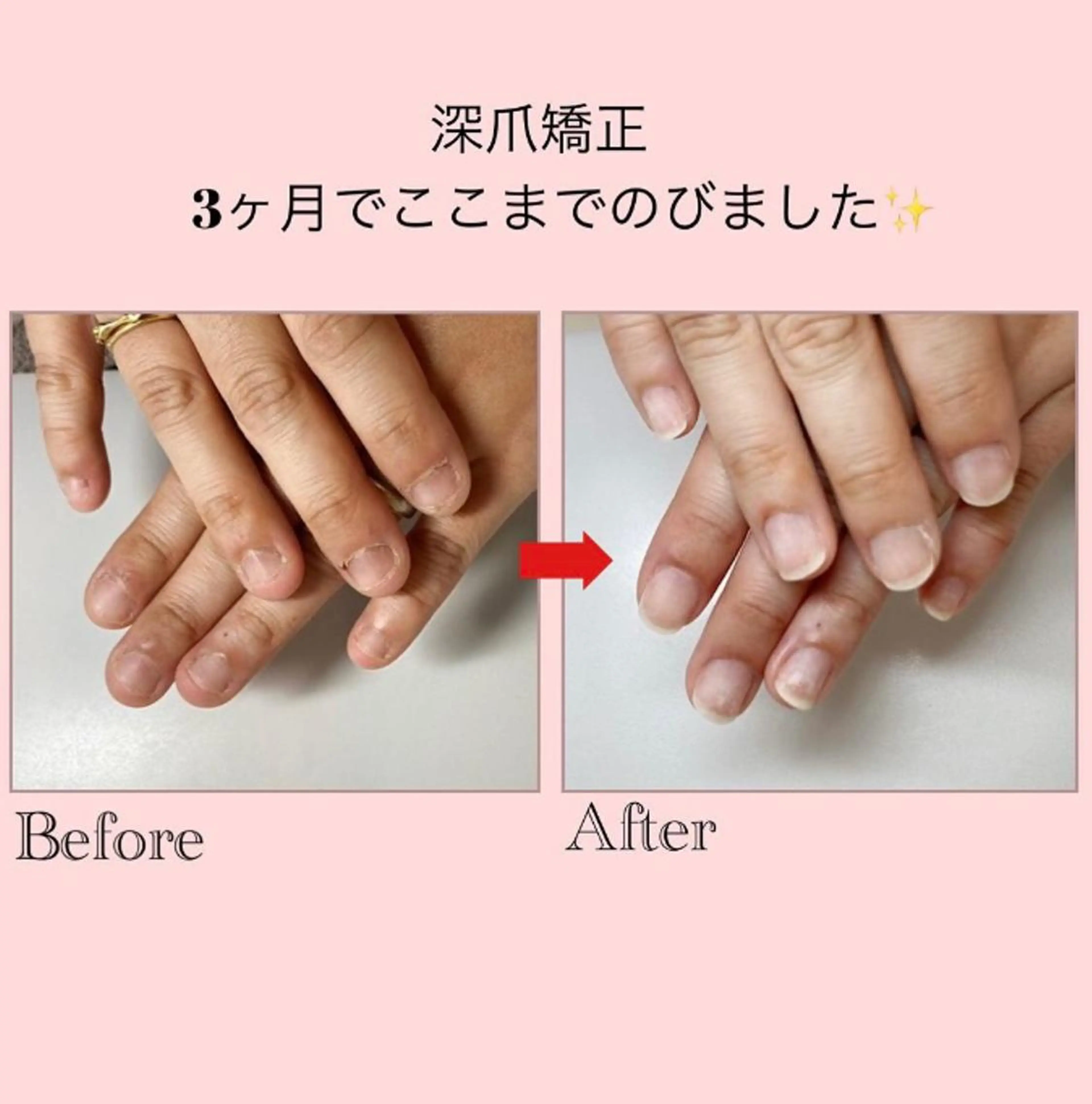 ネイル ネイルサロン アリュームのネイルデザイン