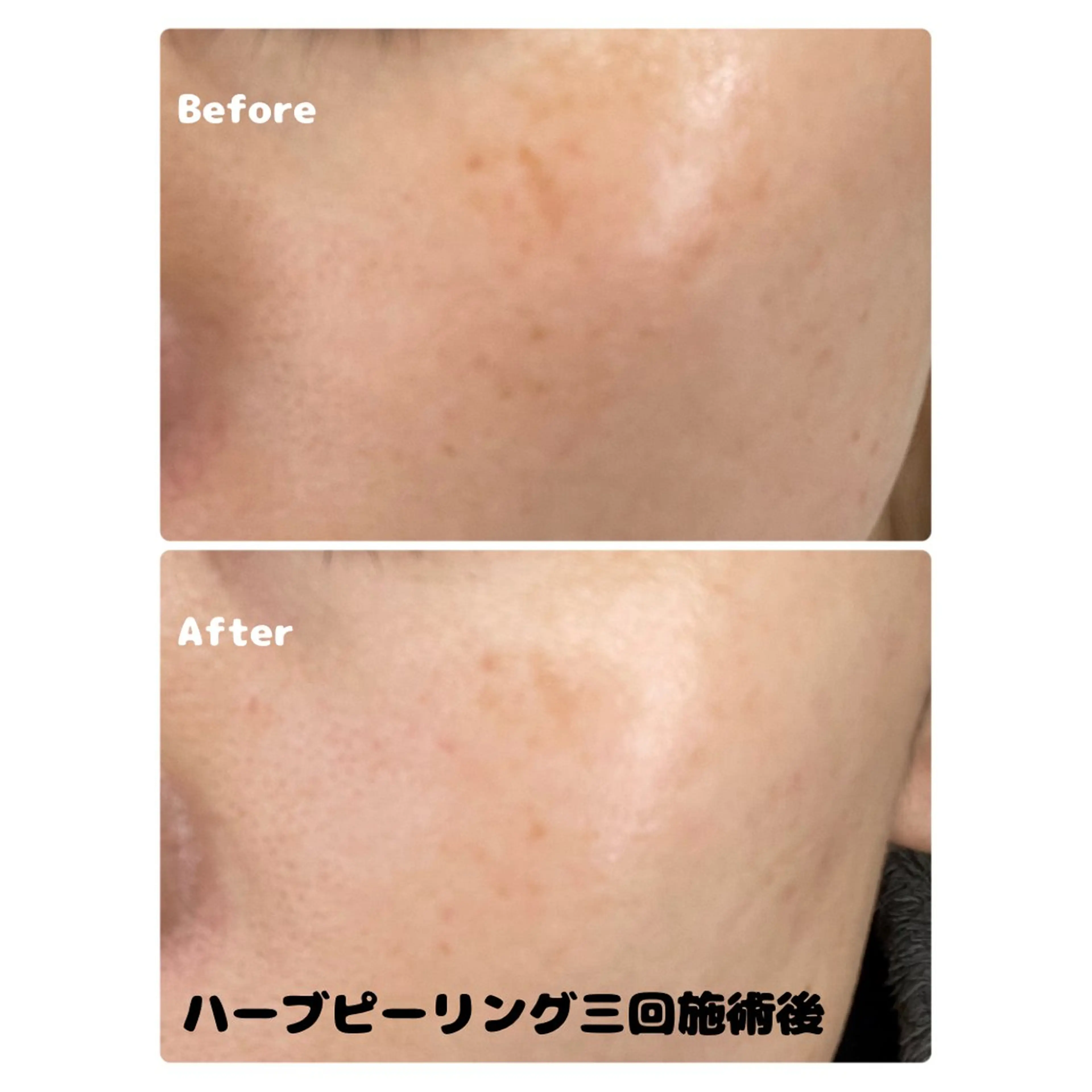 エステ Pono （ポノ）のエステ・リラクイメージ