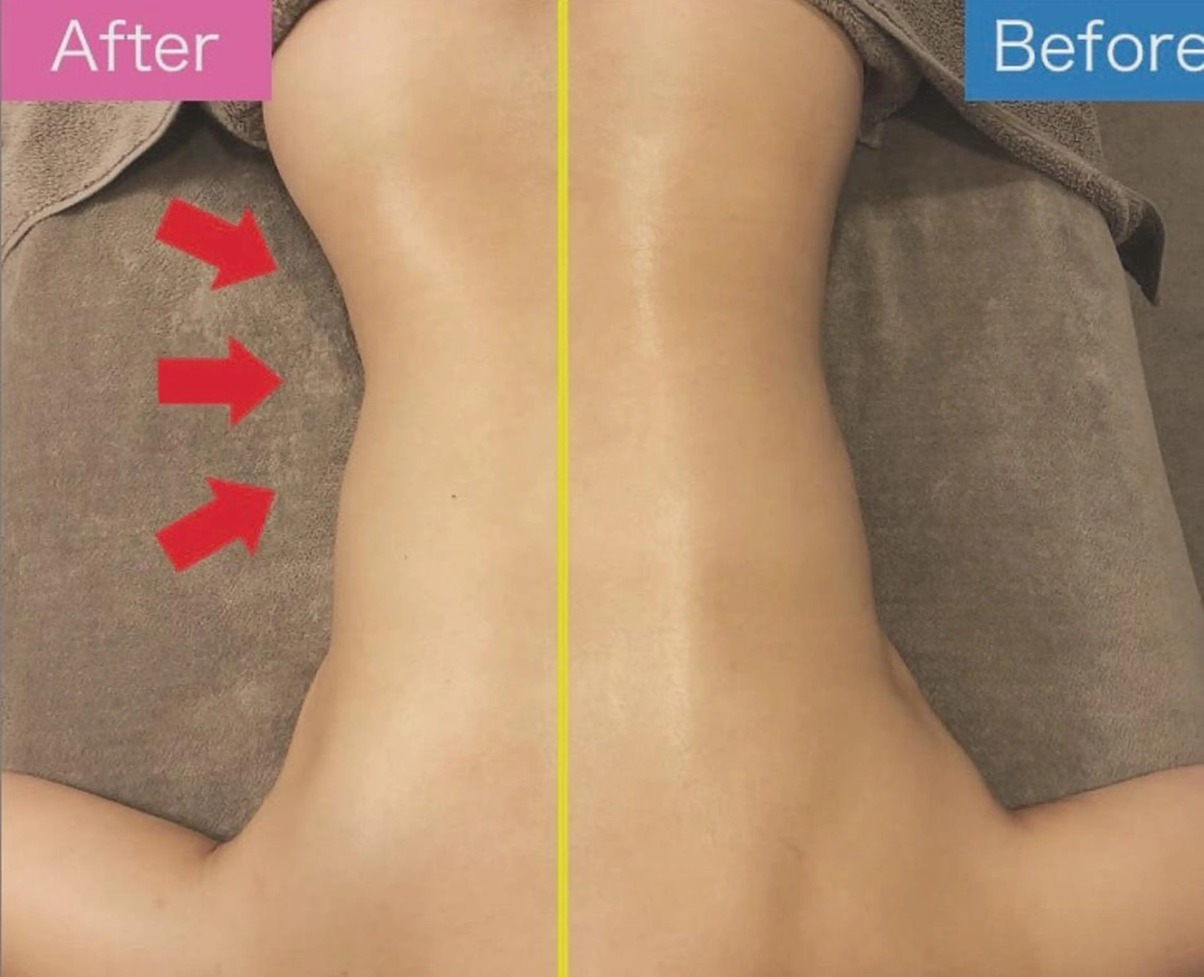 《本気痩せ×疲労改善 》  BILOOPのエステ・リラクイメージ