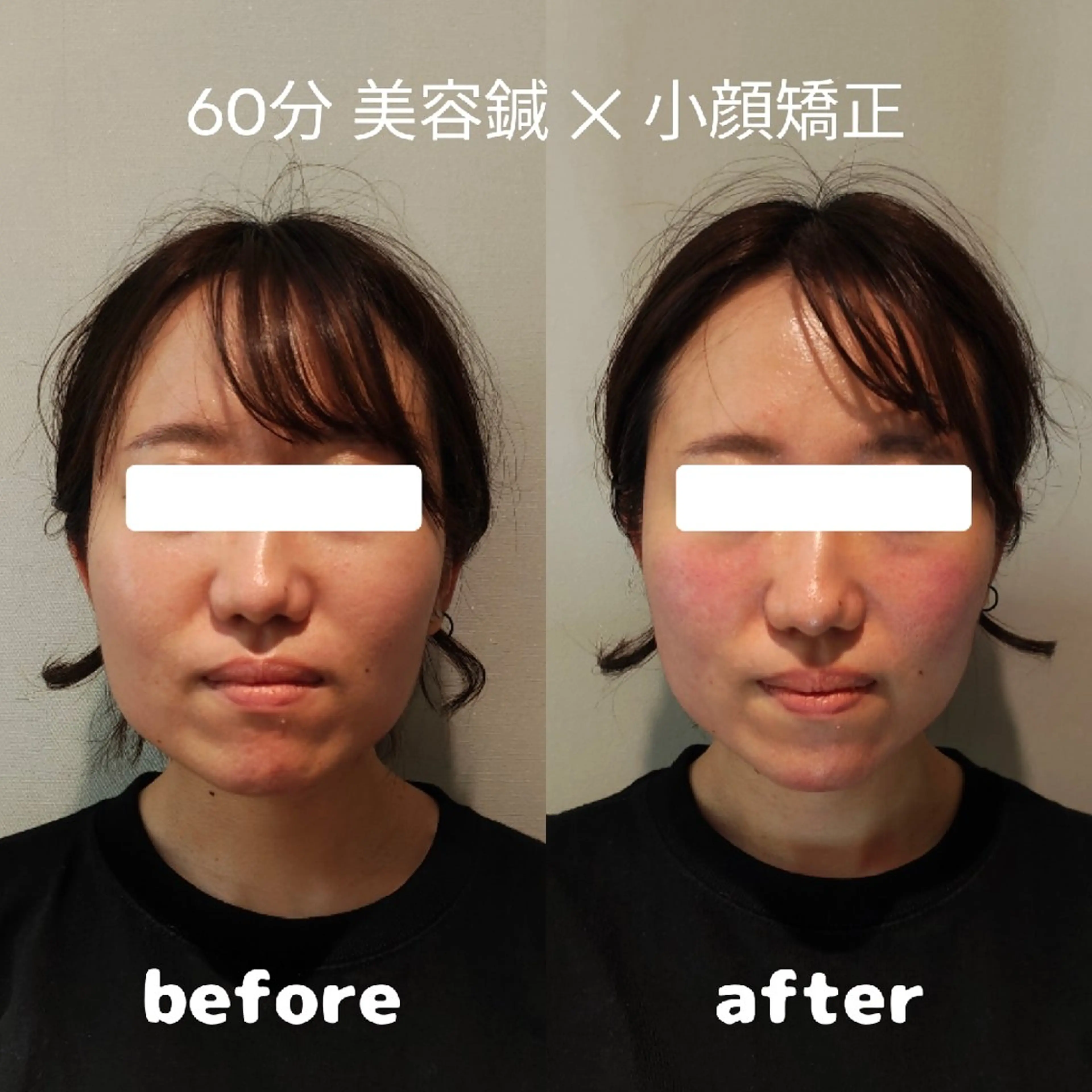 エステ リラク 美容鍼灸サロン怜 -Rei-のエステ・リラクイメージ