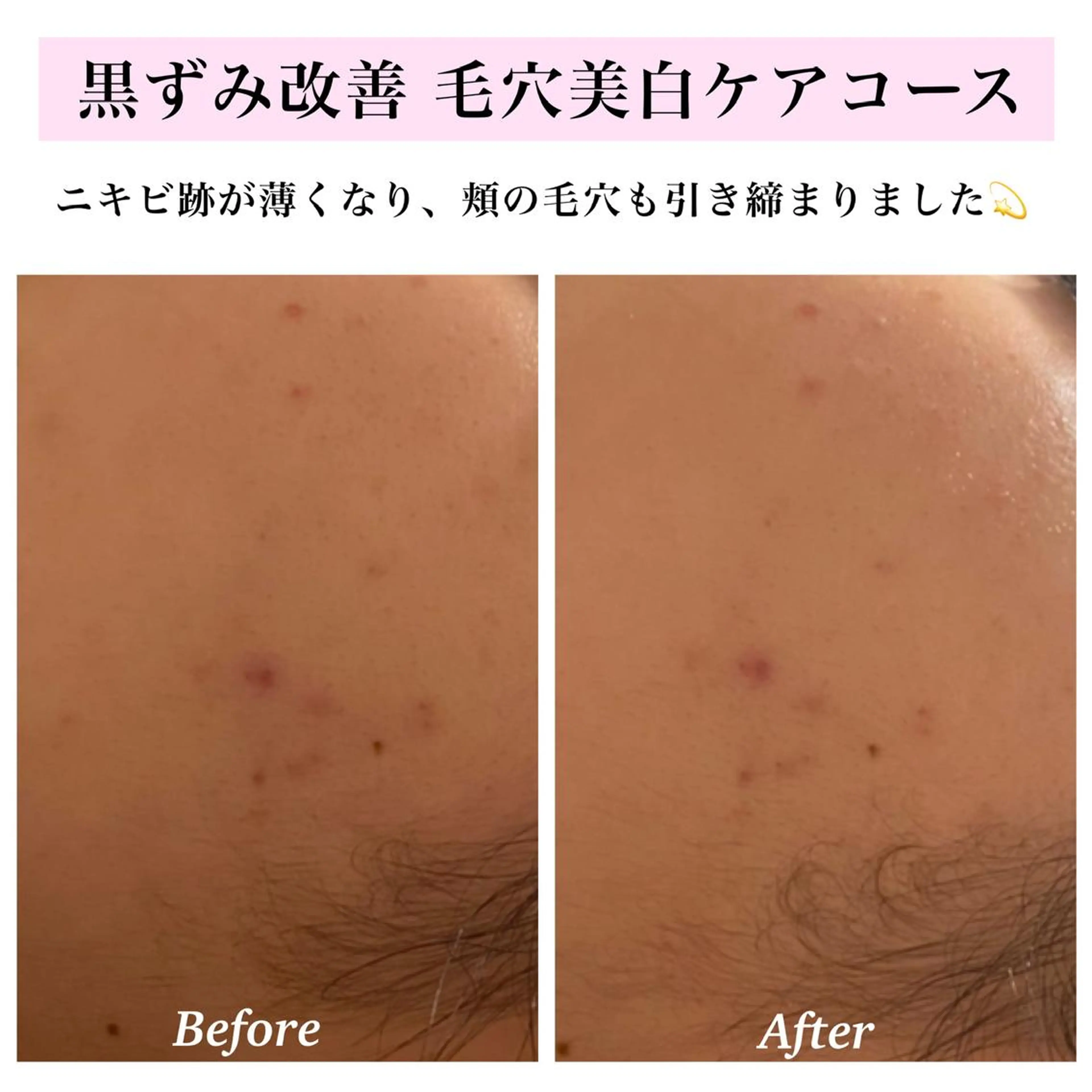 エステ リラク Bellesthe （ベルエステ）のエステ・リラクイメージ