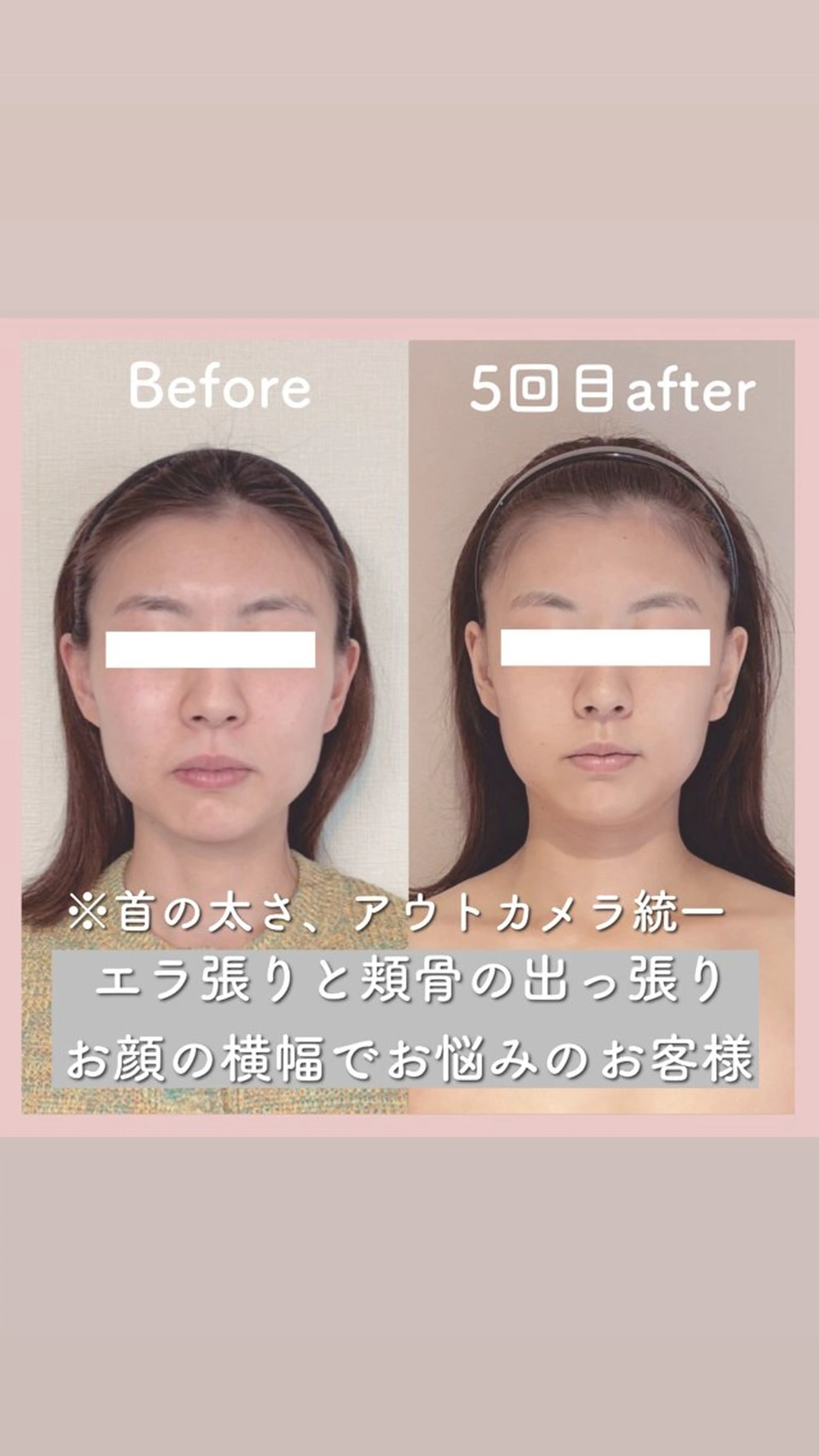 小顔矯正専門店Gémiey所属・越谷駅徒歩３分 小顔専門Gemieyのエステ・リラクイメージ