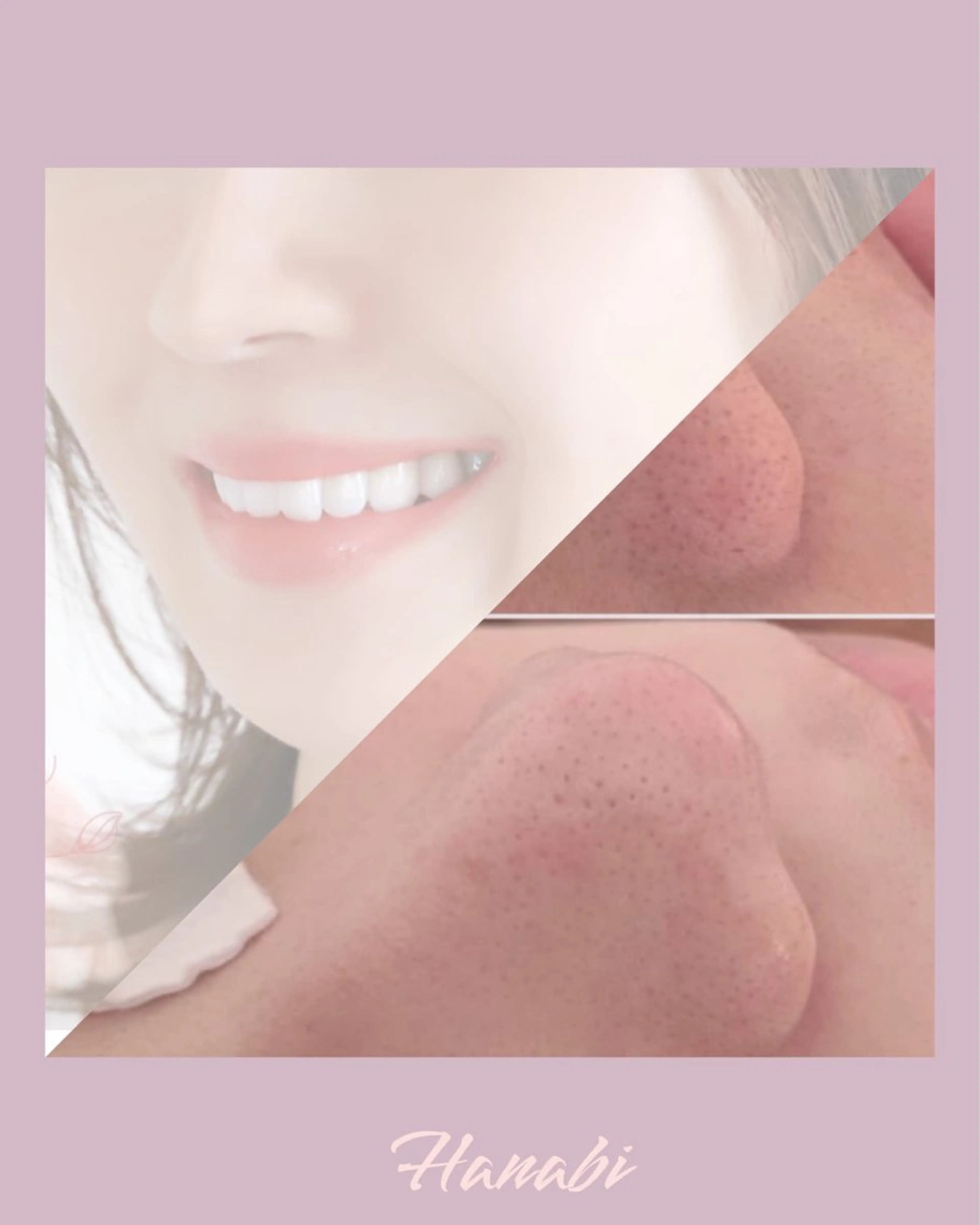 【角栓除去×産毛オフのWケア❣️】毛穴もくすみも同時に整う最強ダブルケア！忙しい人にもオススメです✨の写真