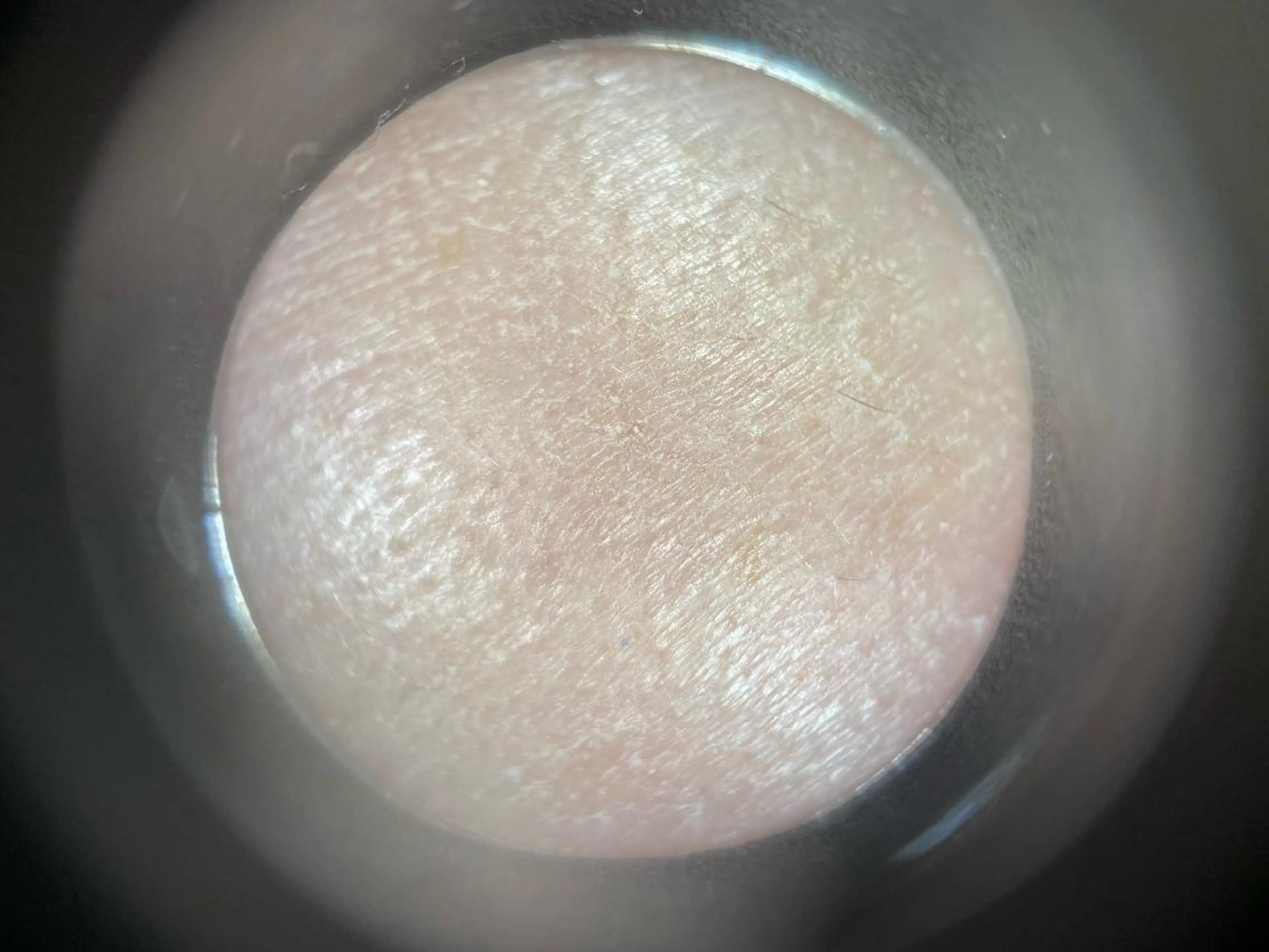 ショート ネイル アイブロウ 小倉 麻由のエステ・リラクイメージ