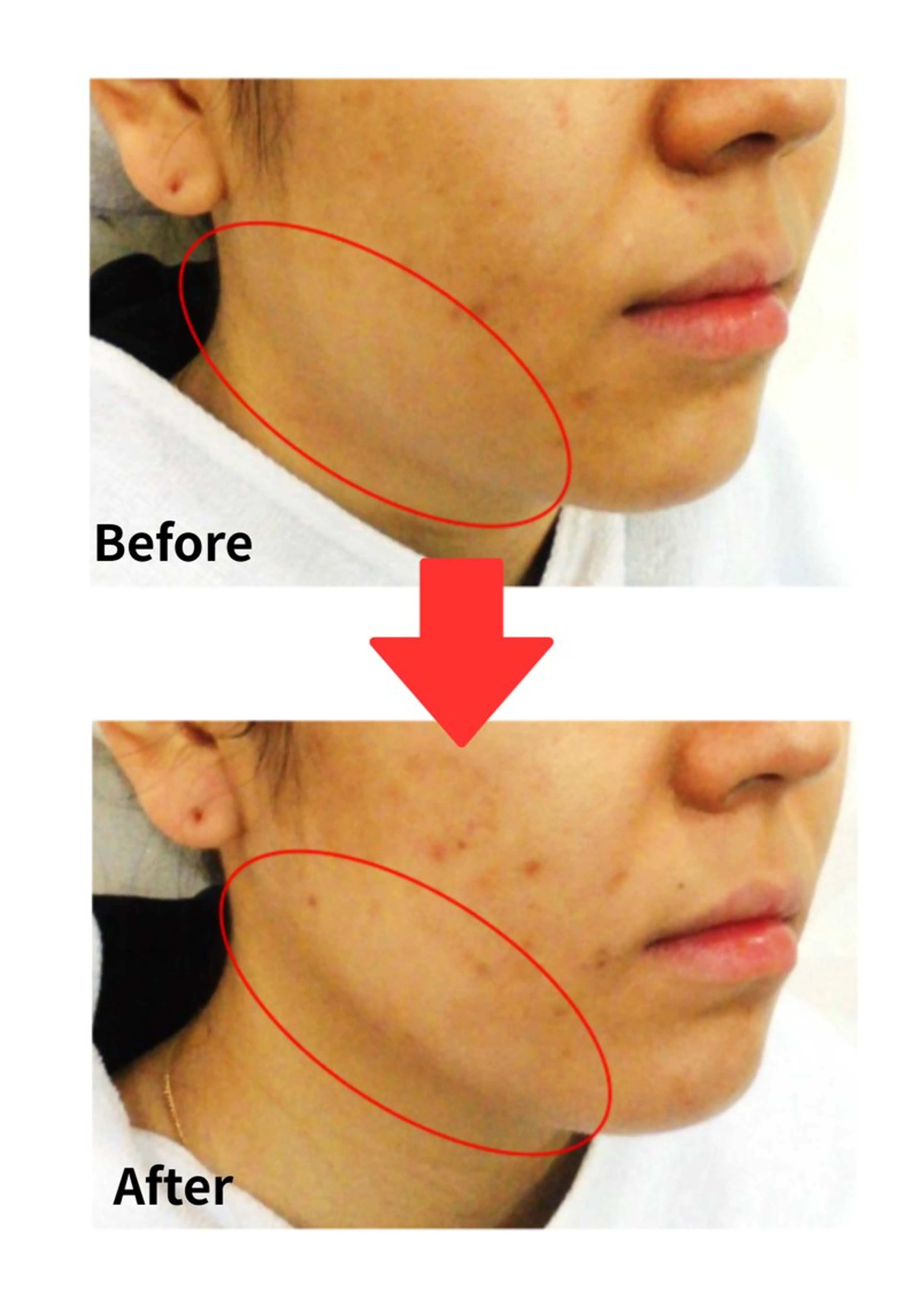 Belle White所属・本格痩身＊透明美肌 BelleWhiteのエステ・リラクイメージ