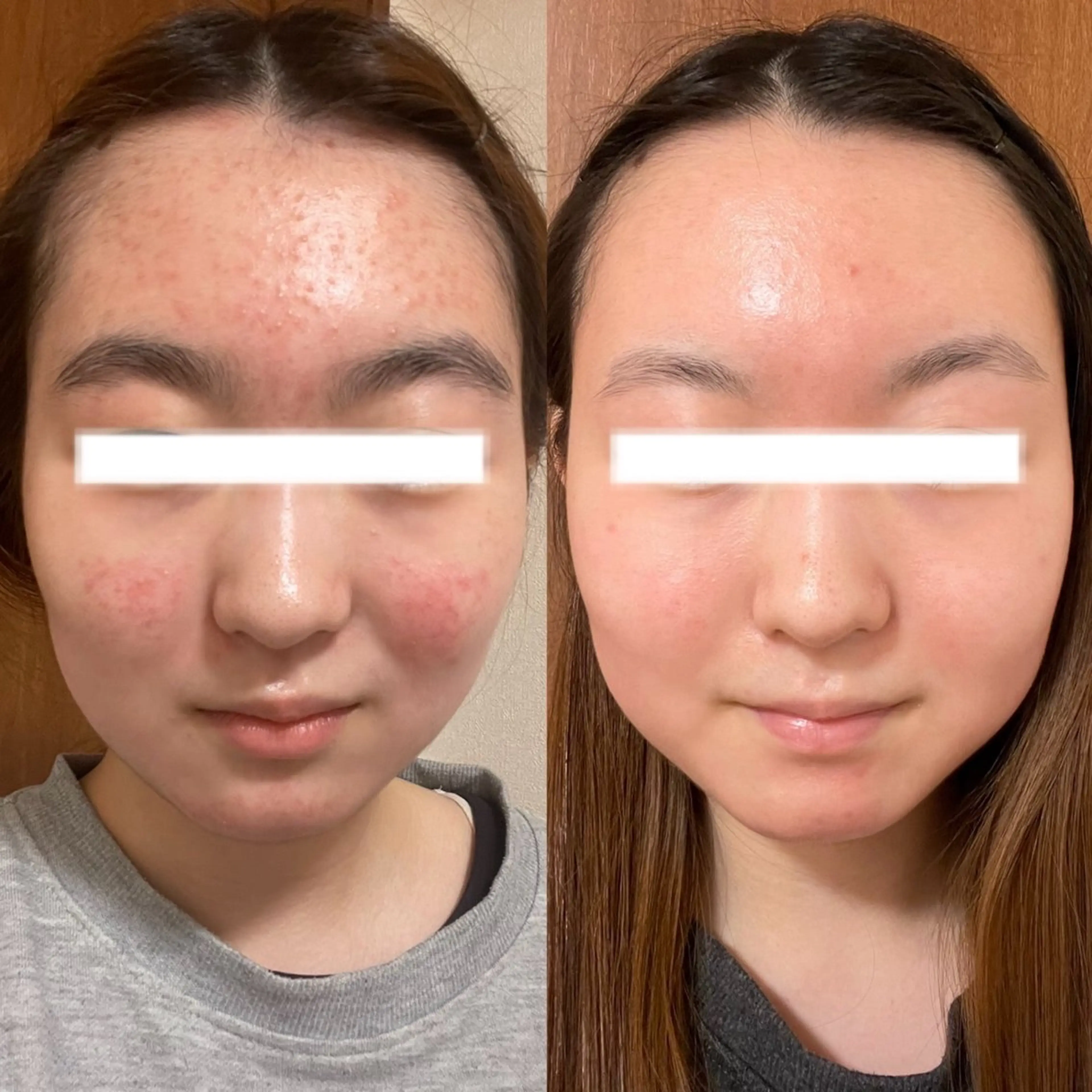 脱毛・肌質改善サロン Linoのエステ・リラクイメージ