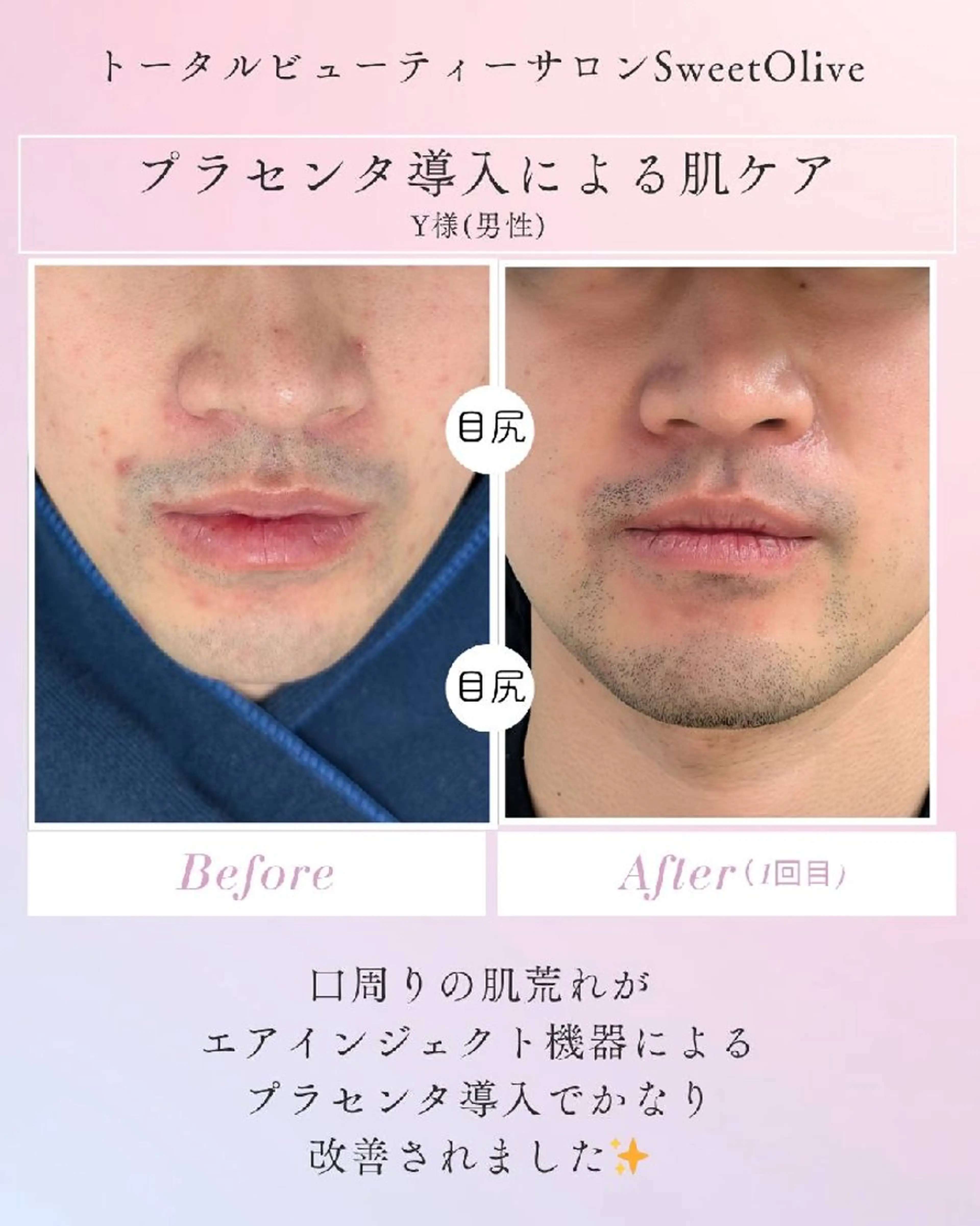 エステ SweetOlive 　 Akaneのエステ・リラクイメージ