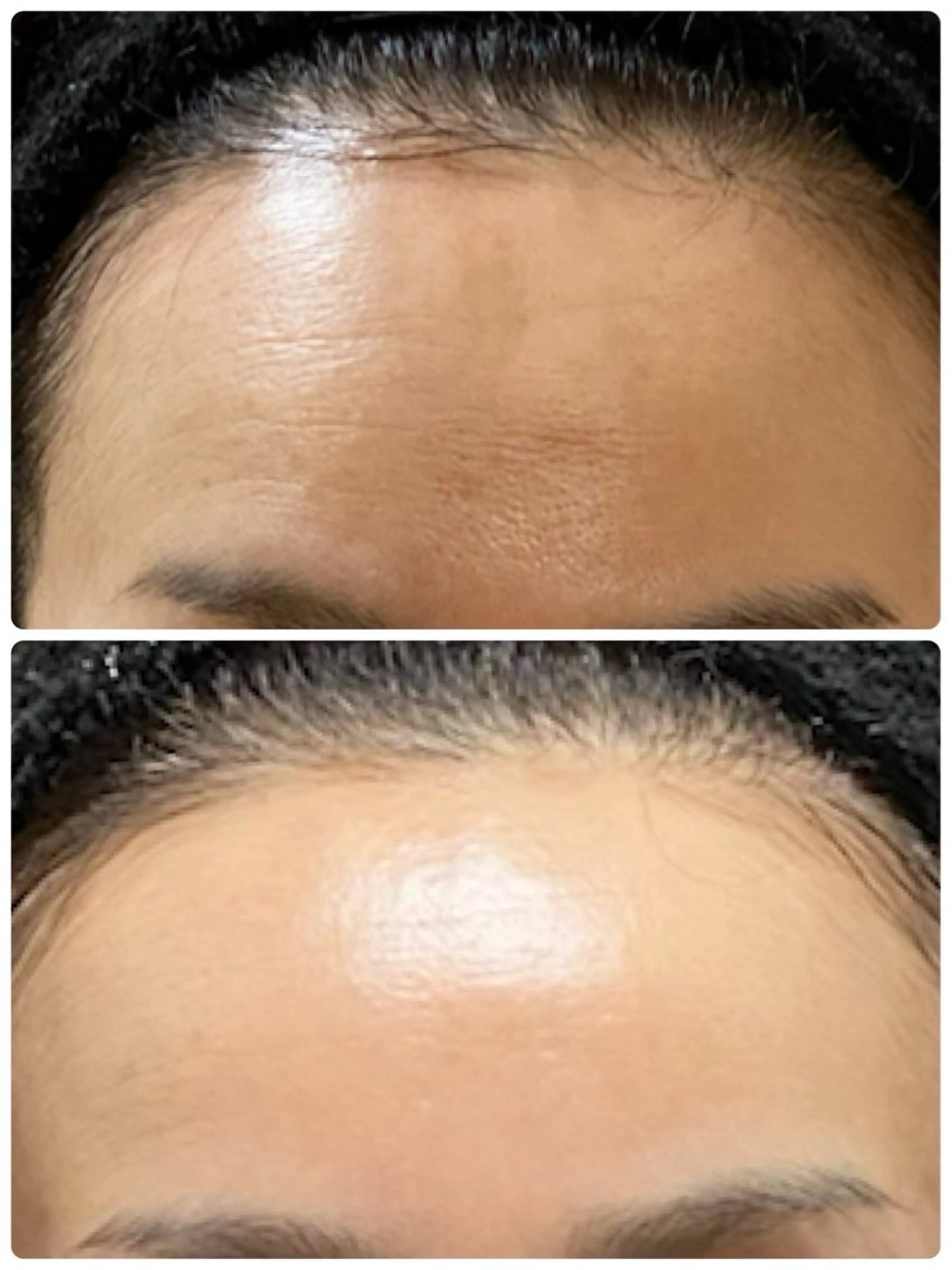 肌の質を変えるエステ 🤍🫧Nanaのエステ・リラクイメージ