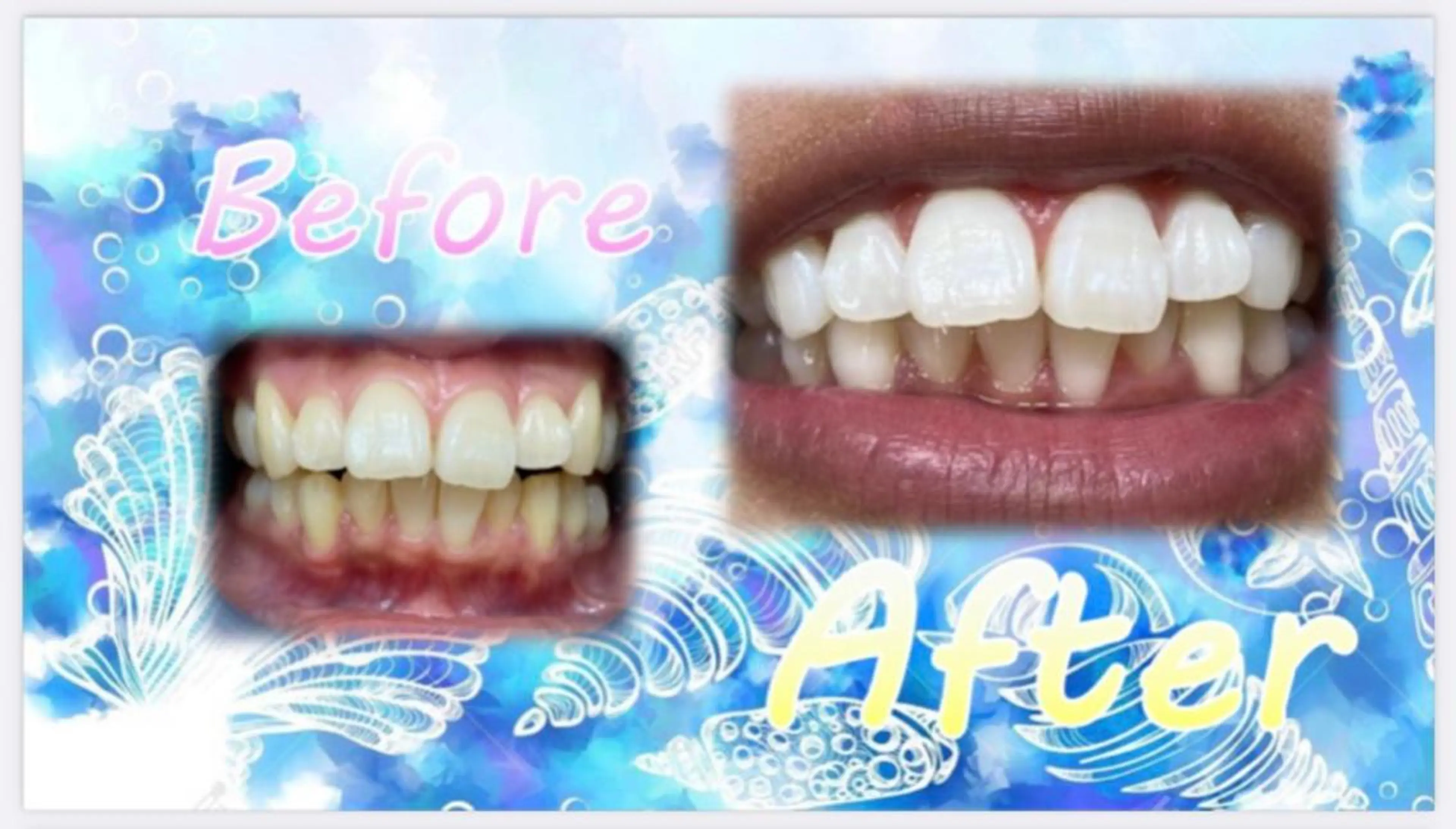 その他 ホワイトニングサロン La vie enのその他イメージ