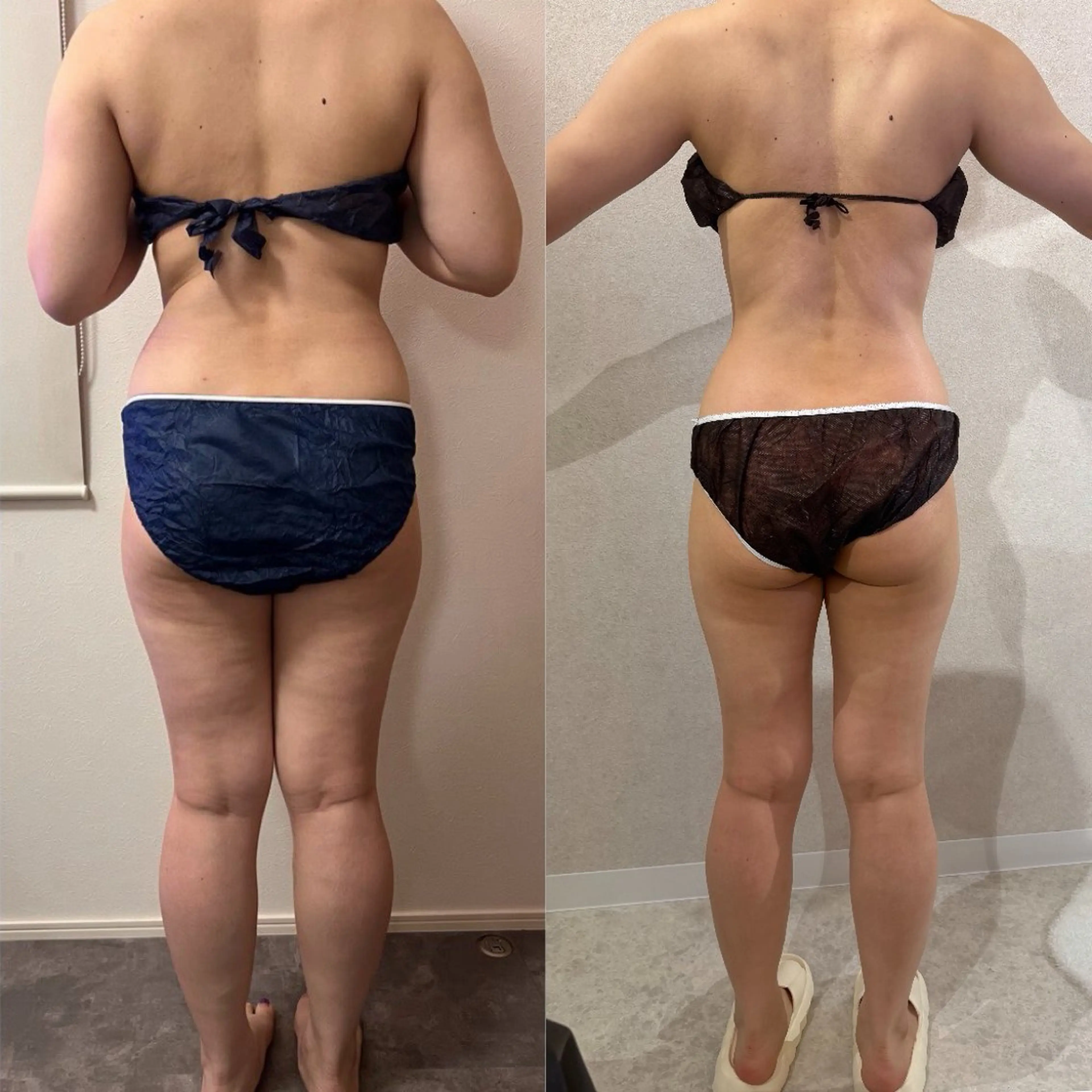 エステ Raviy(A.) 【痩身・韓国肌管理】のエステ・リラクイメージ