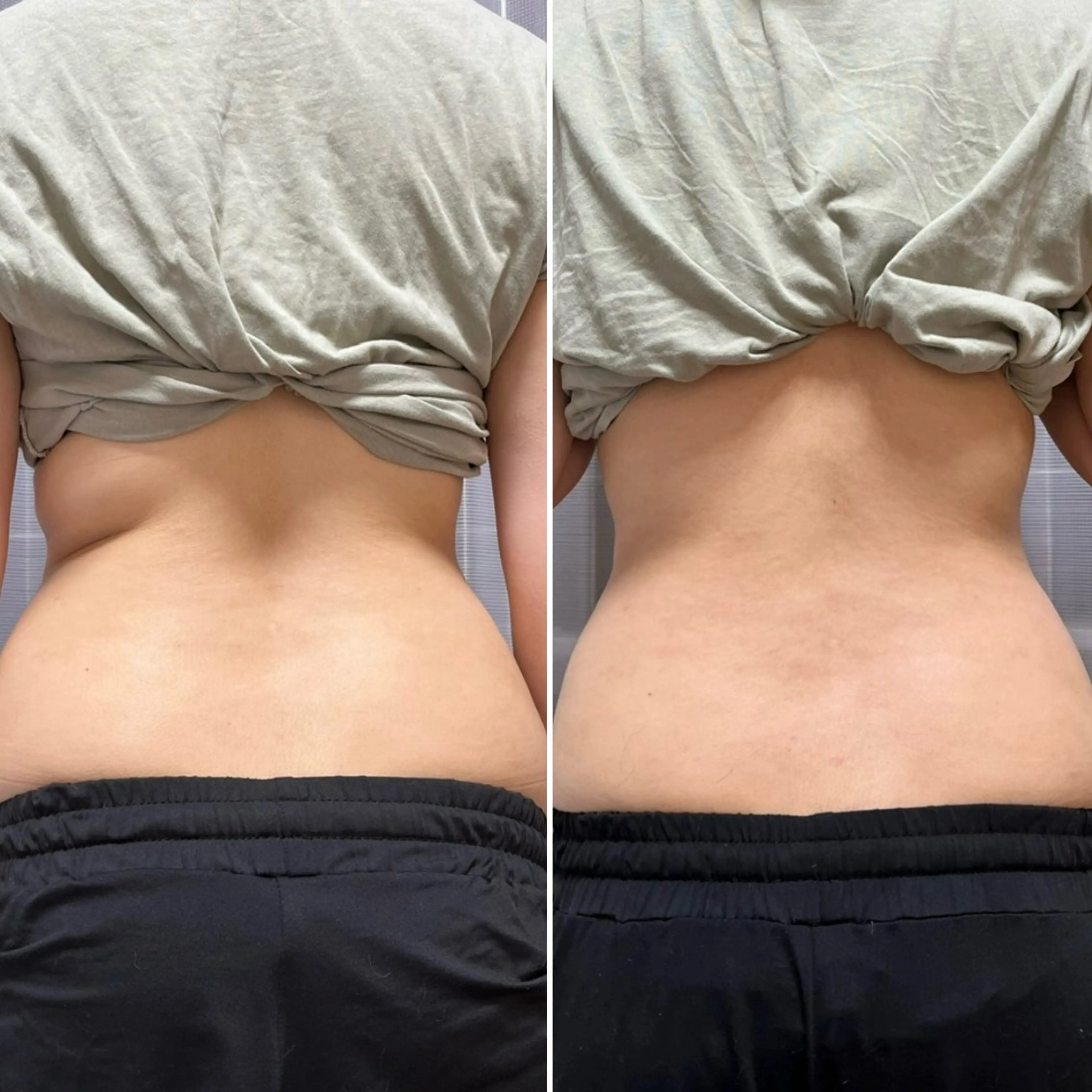 くびれ腸もみリンパケアの写真