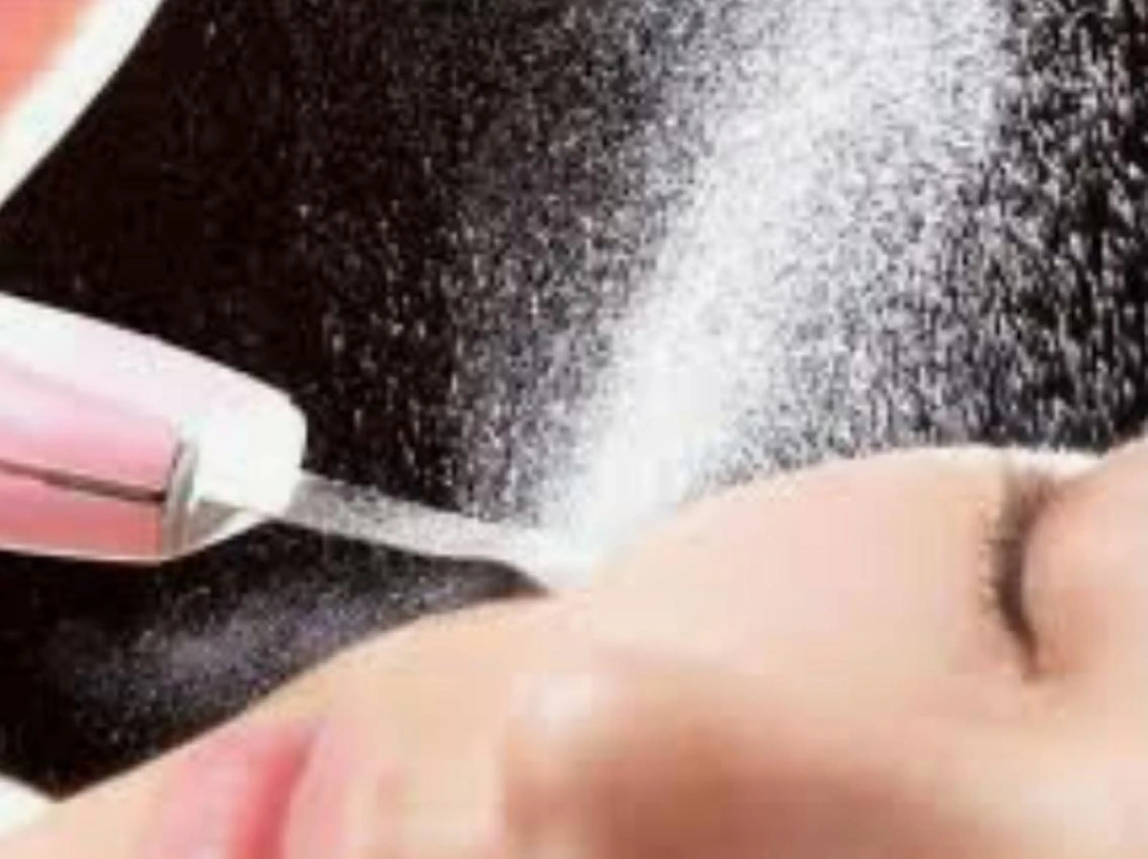 毛穴洗浄の写真