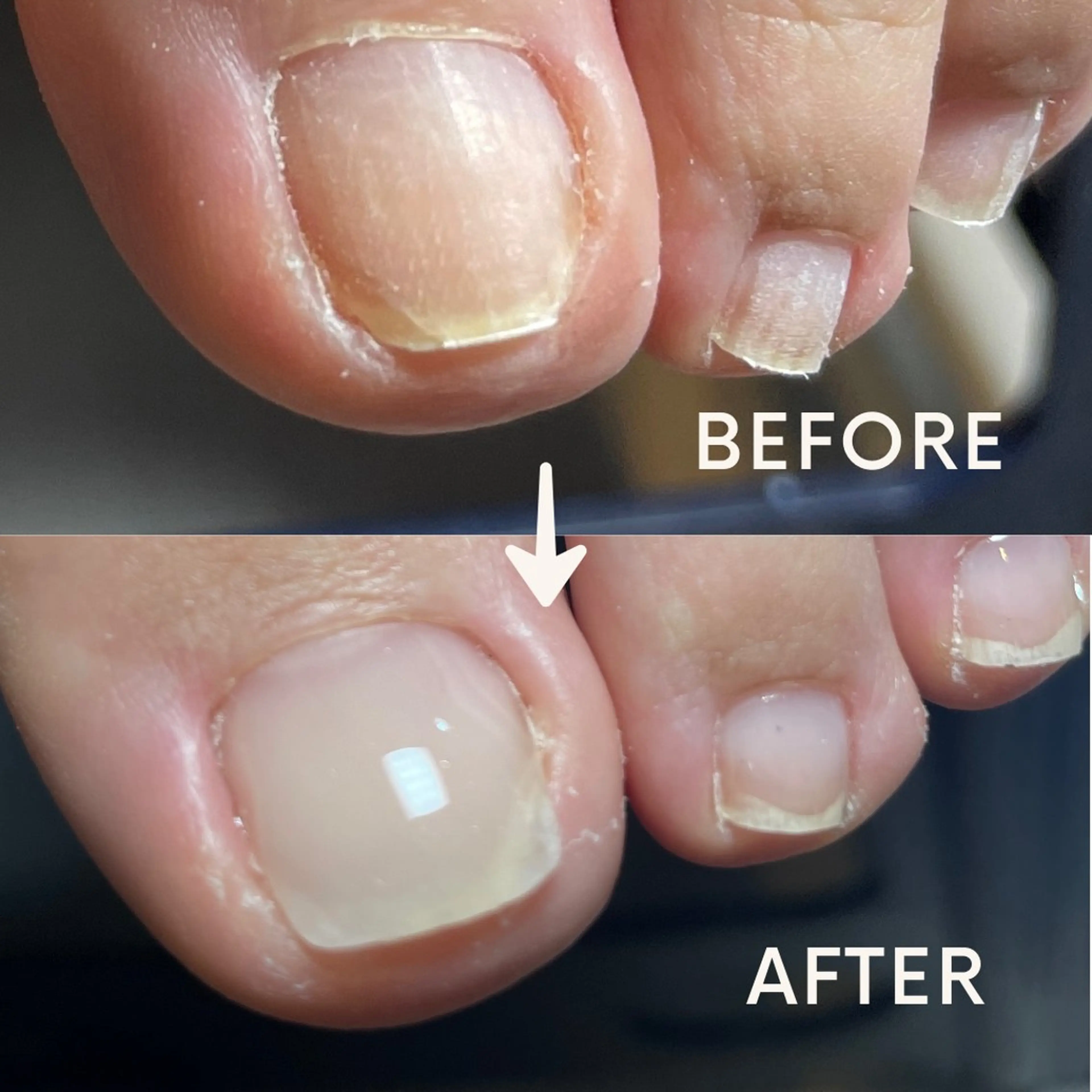 e miのネイルデザイン