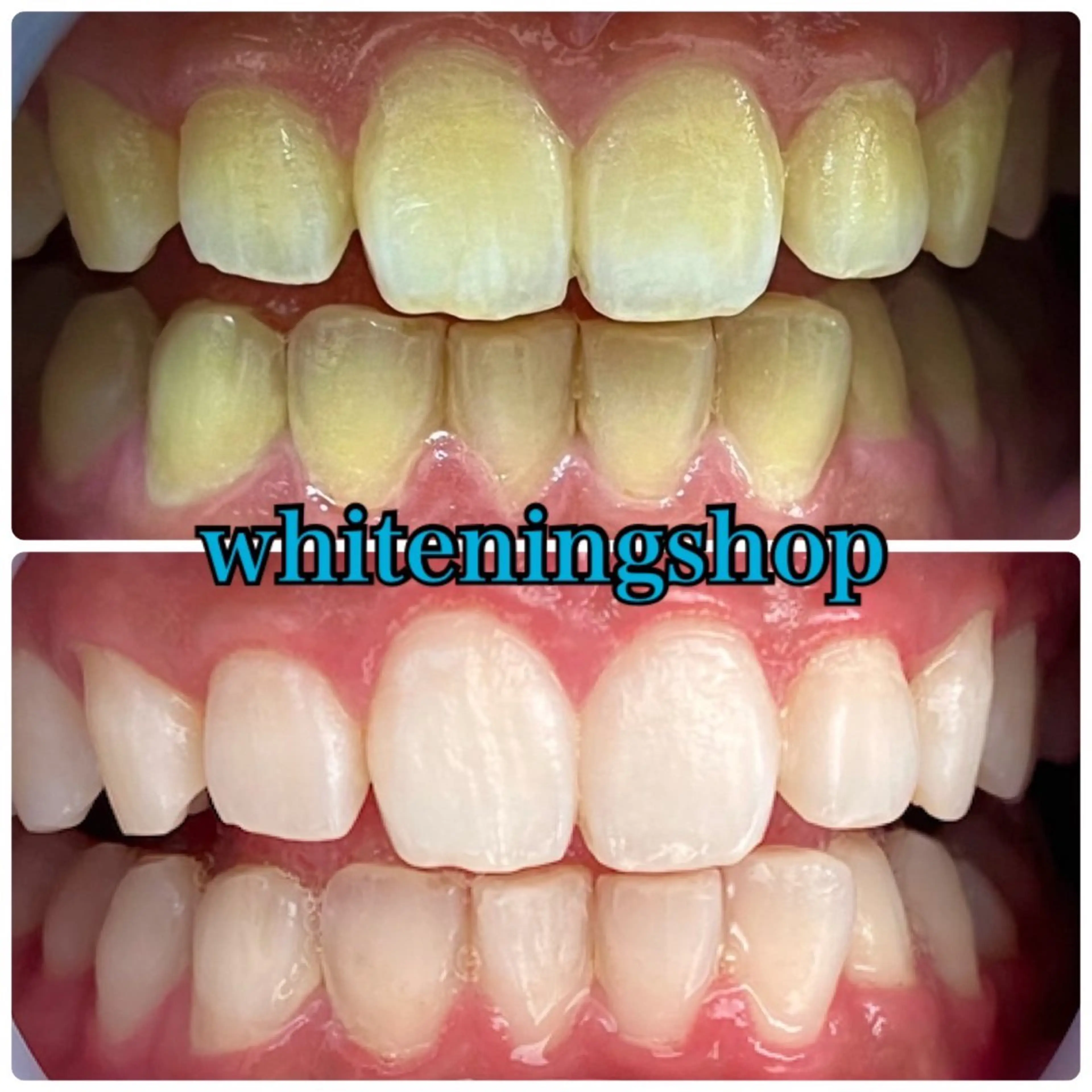 エステ リラク ホワイトニング ショップ吉祥寺店のエステ・リラクイメージ