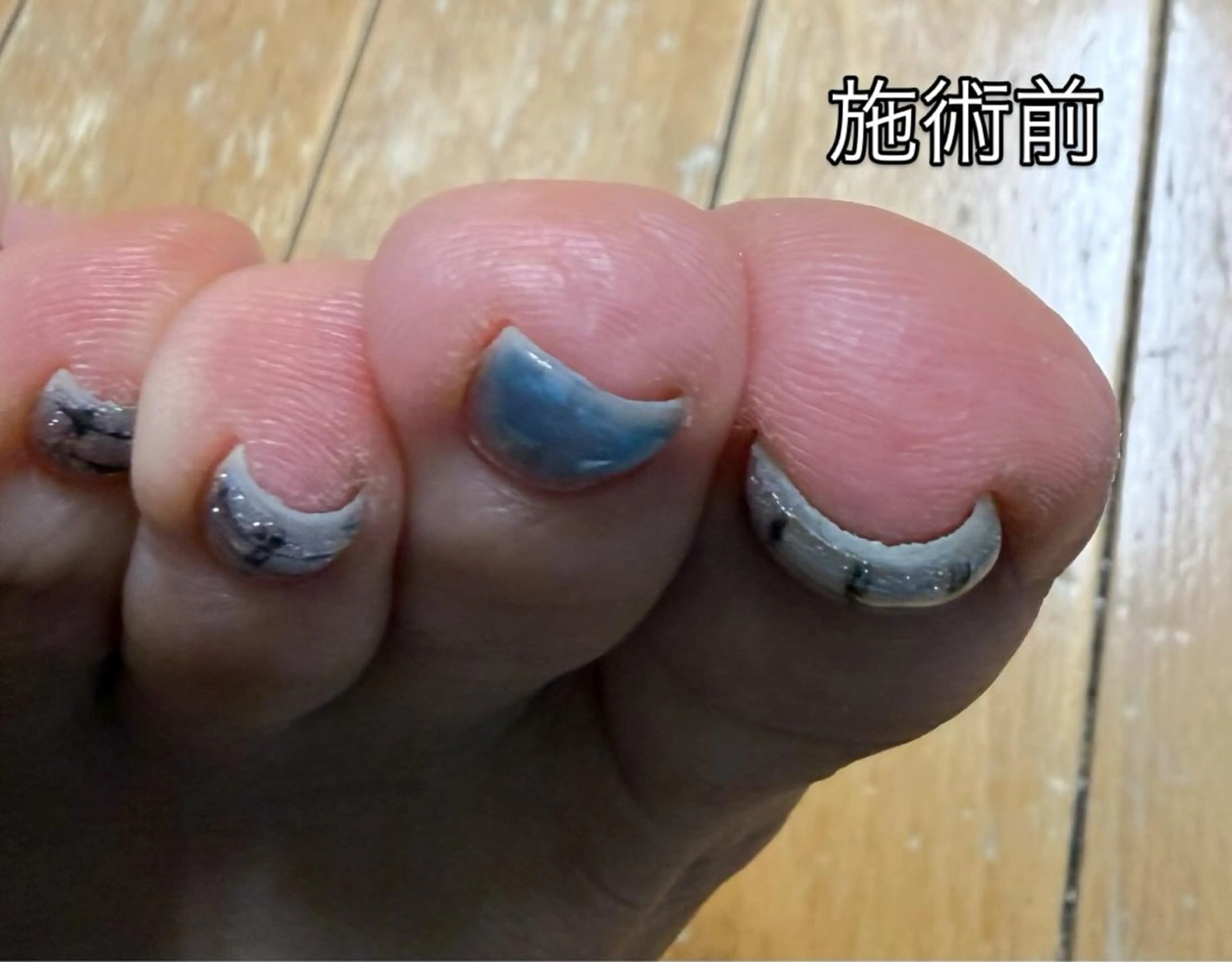 ネイル koko nailのネイルデザイン