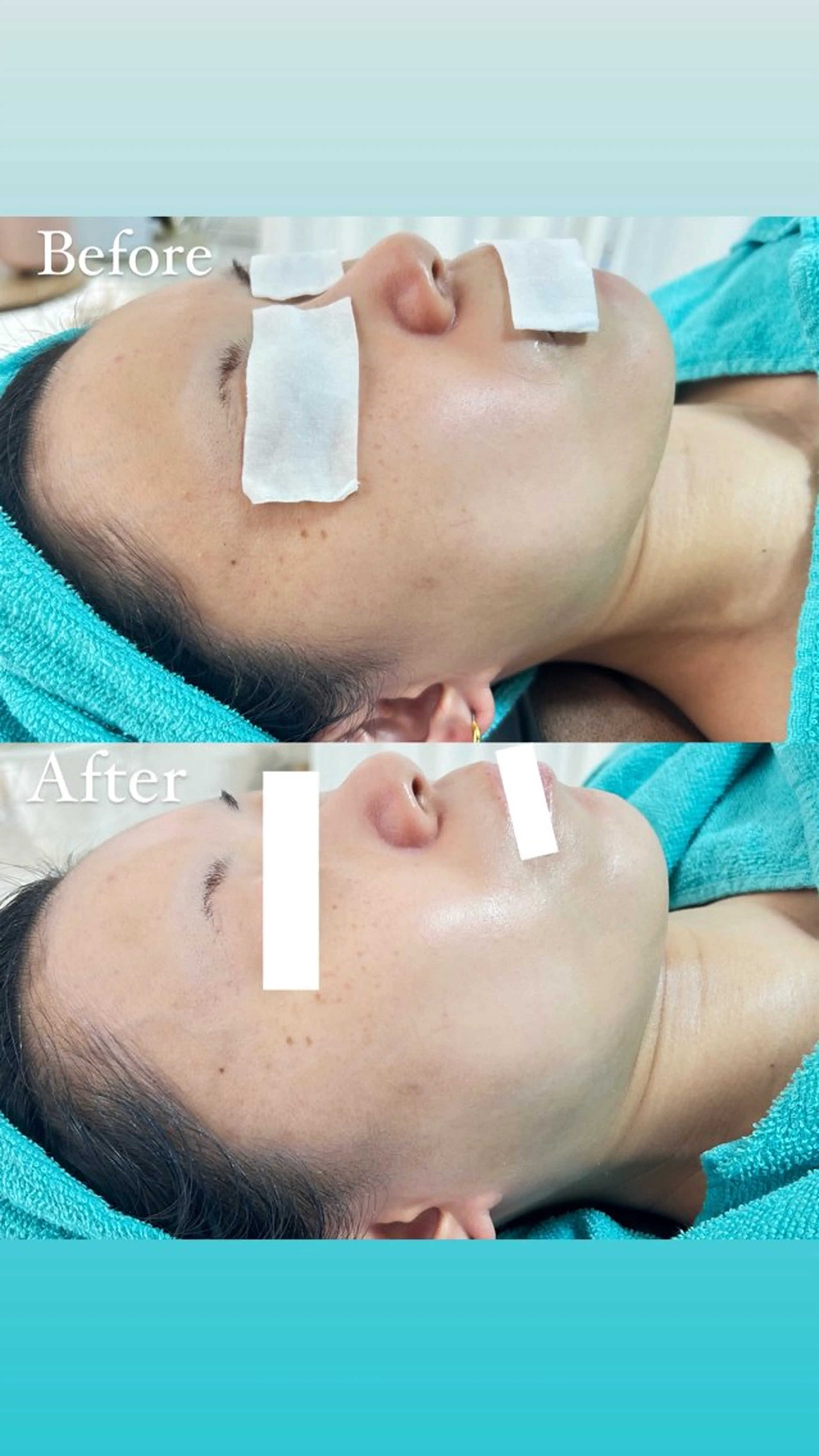 エステ Be Charm 山﨑のエステ・リラクイメージ