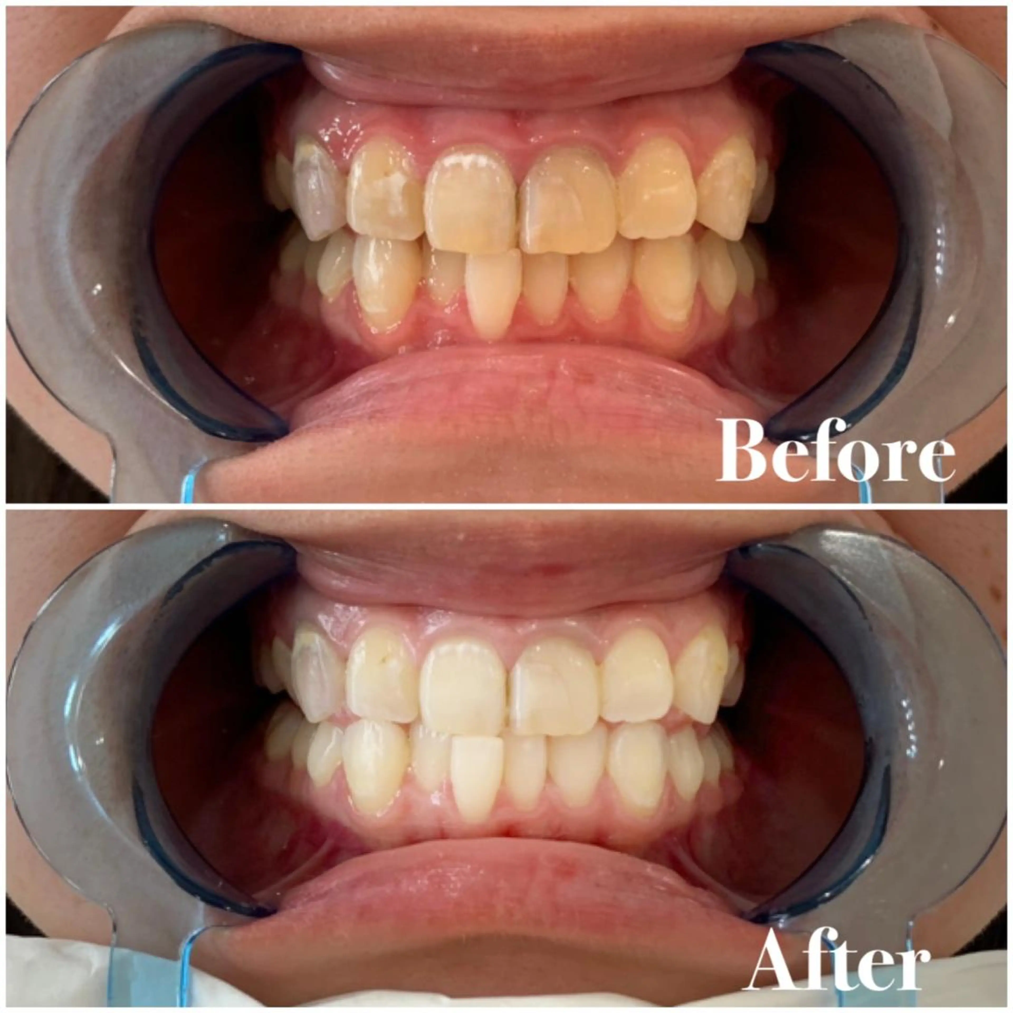 セミロング パーマ キッズ アイブロウ マツエク・マツパ メンズ カラー ヘアアレンジ ネイル エステ リラク ライトビューティー 銀座店のエステ・リラクイメージ