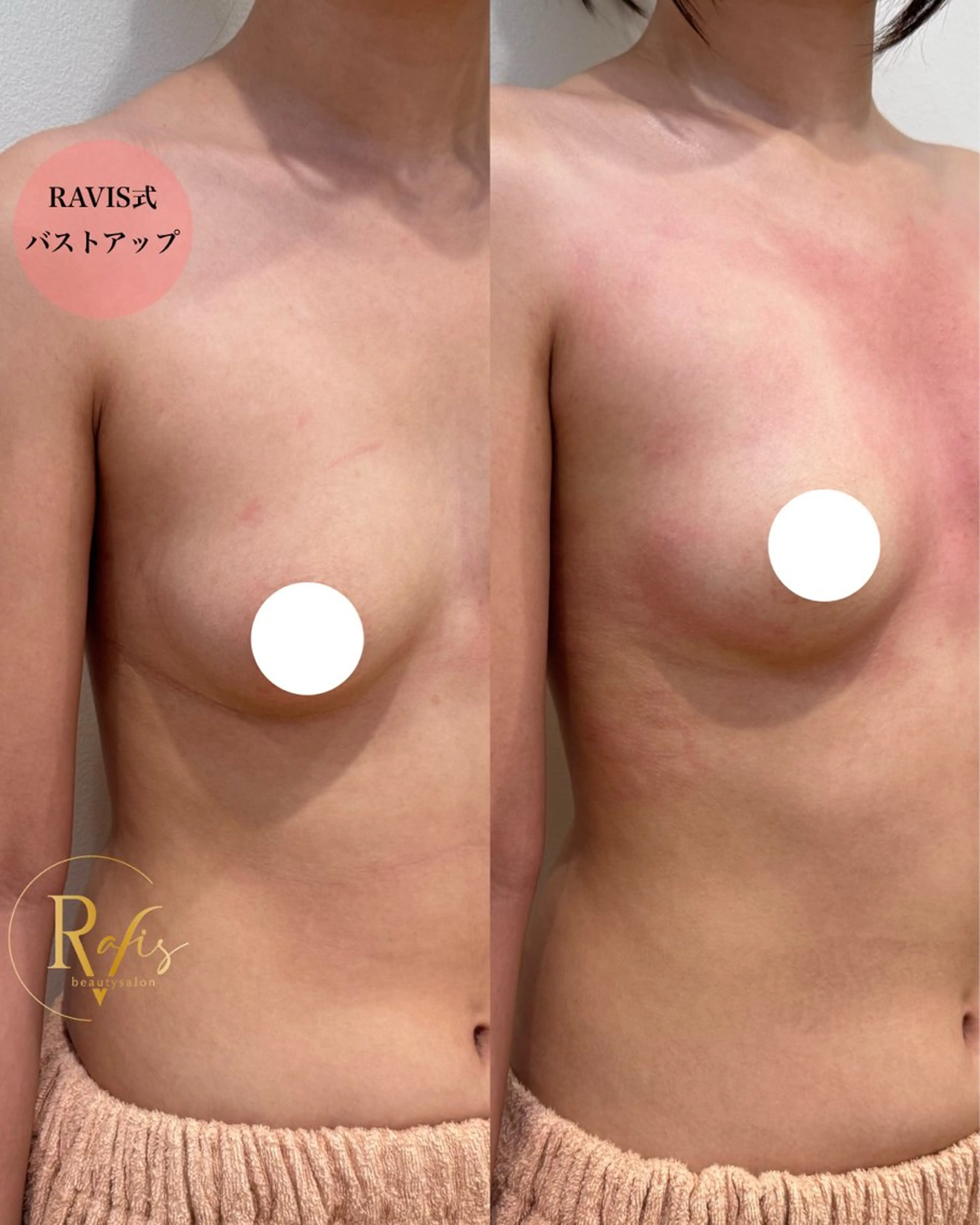 エステ 東大阪/韓国肌管理/ 痩身バスト専門店のエステ・リラクイメージ