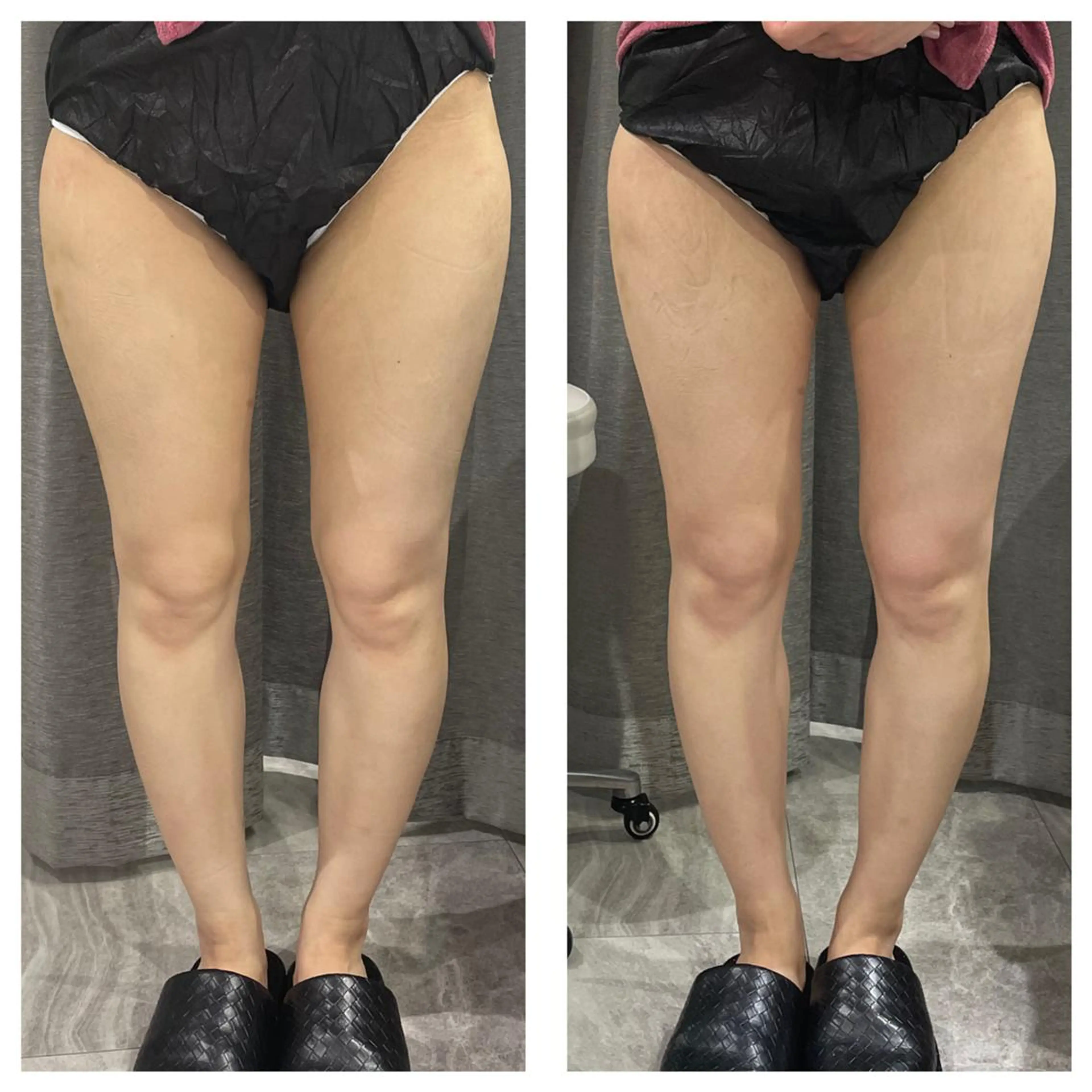 エステ リラク 部分痩せ♥️小顔専門 MIKUのエステ・リラクイメージ