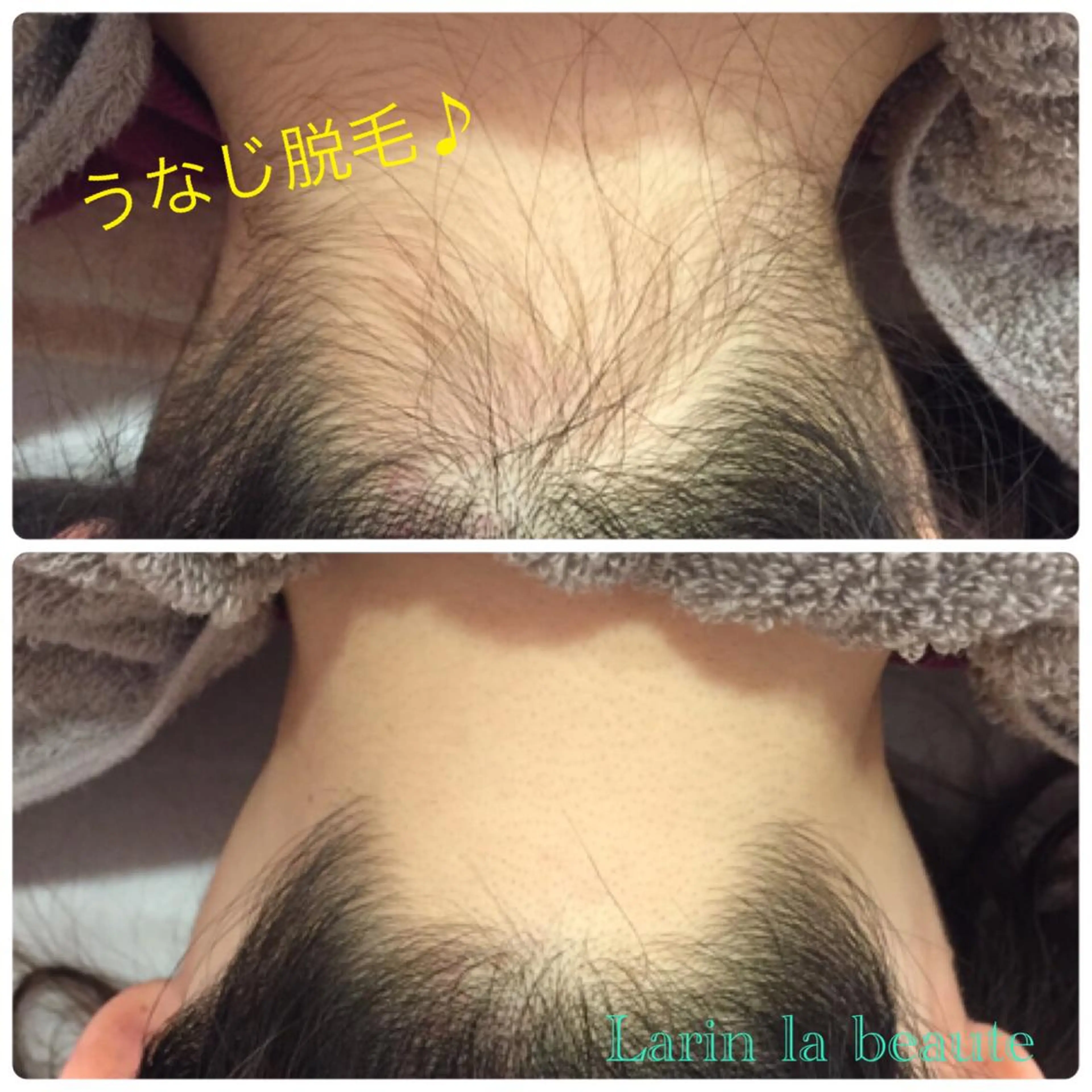 脱毛 美肌脱毛・ハーブピーリング専門店Larin la beaute所属・Larin la beauteのエステ・リラクイメージ