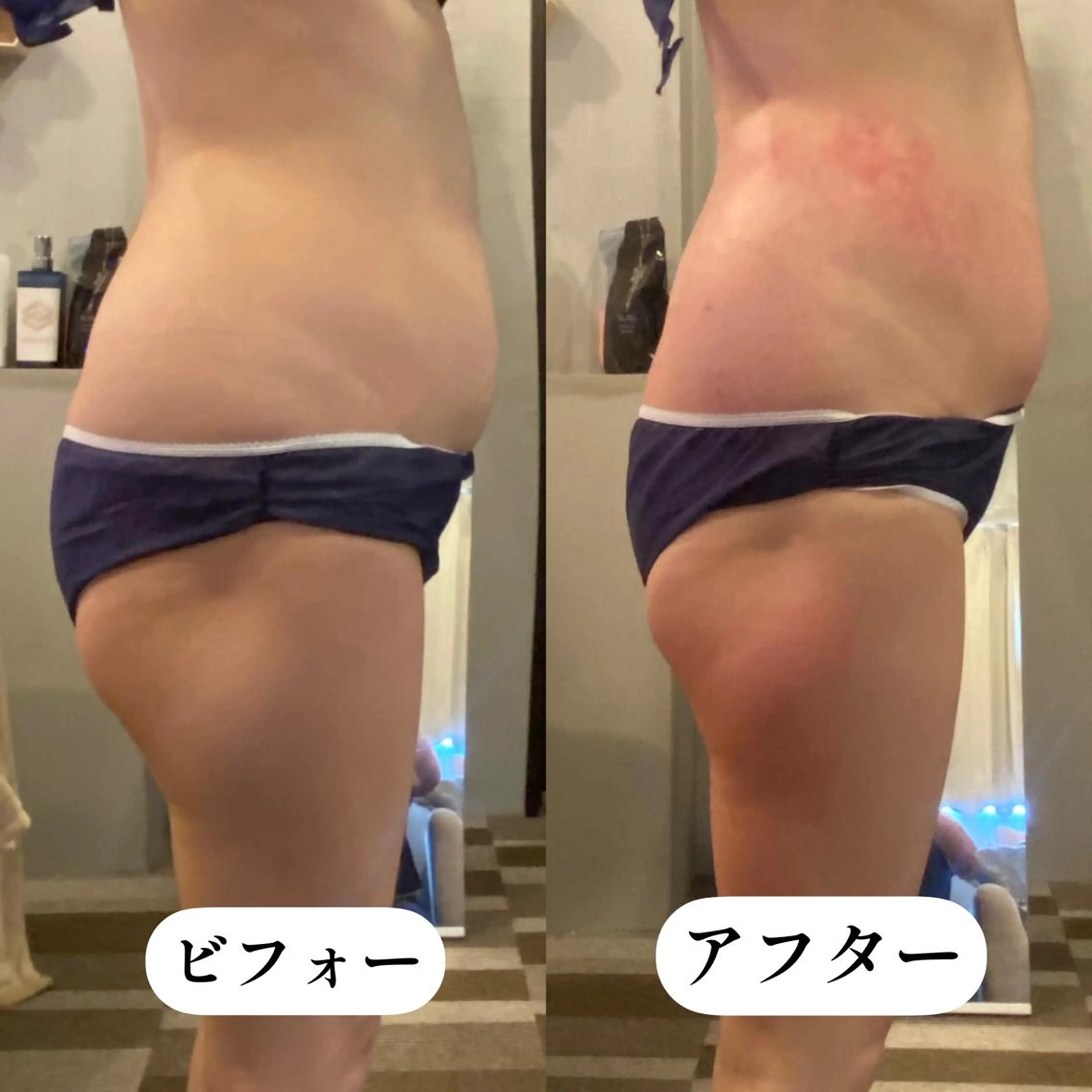 エステ リラク トータルビューティー TEIKOKUのエステ・リラクイメージ