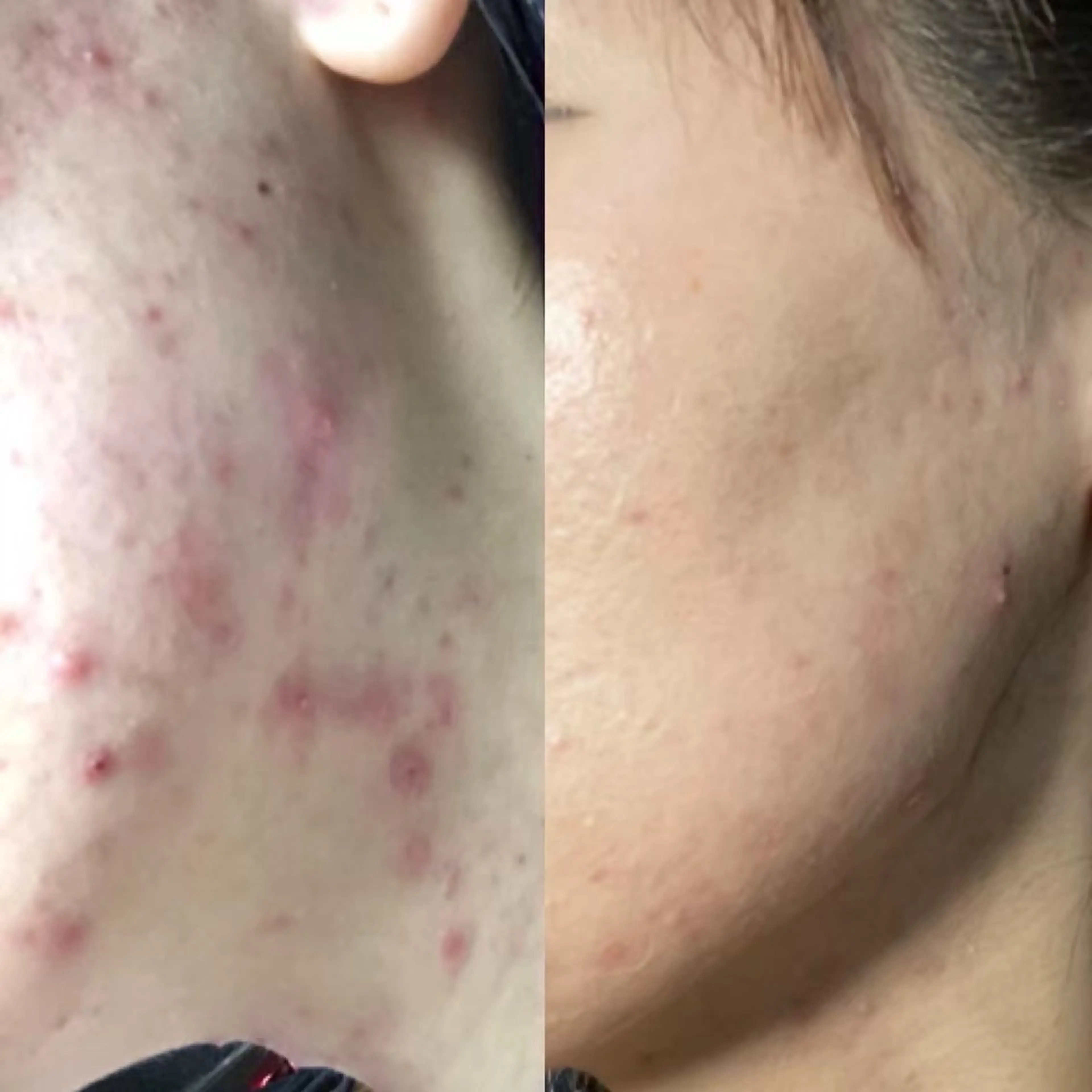 エステ 石川 彩花のエステ・リラクイメージ