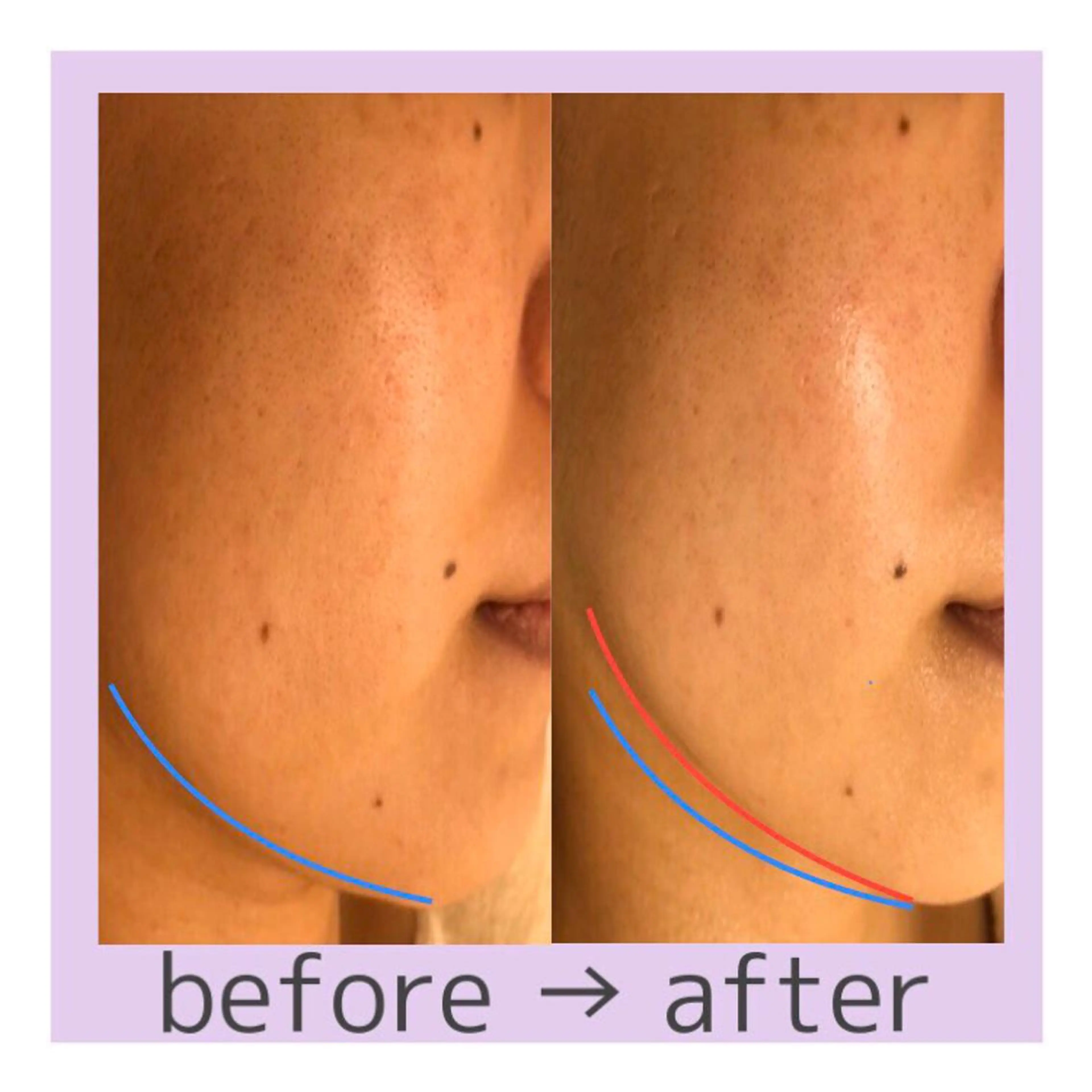 リラク 大人の 毛穴ケア専門店のその他イメージ