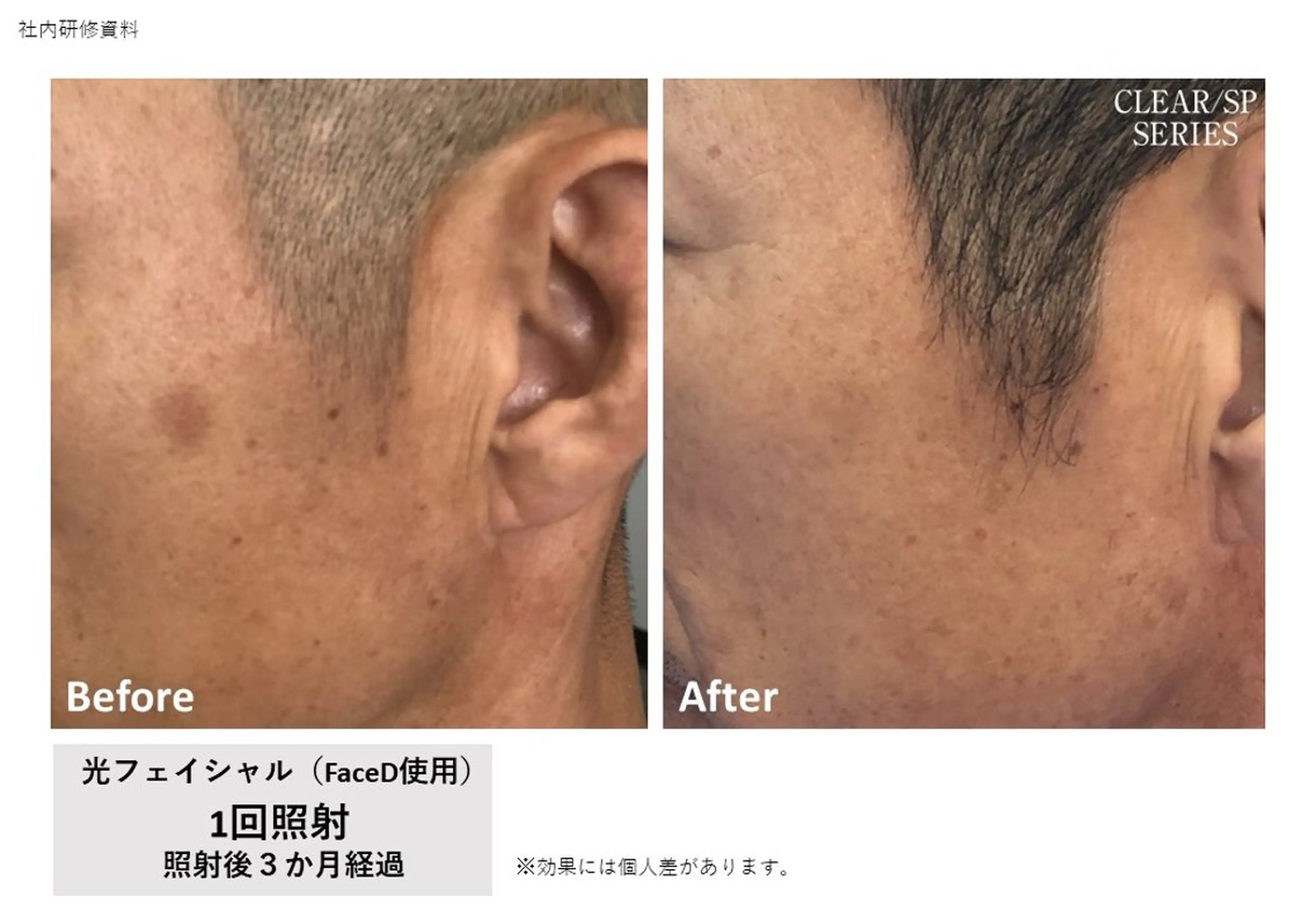 VIERU YURIのネイルデザイン