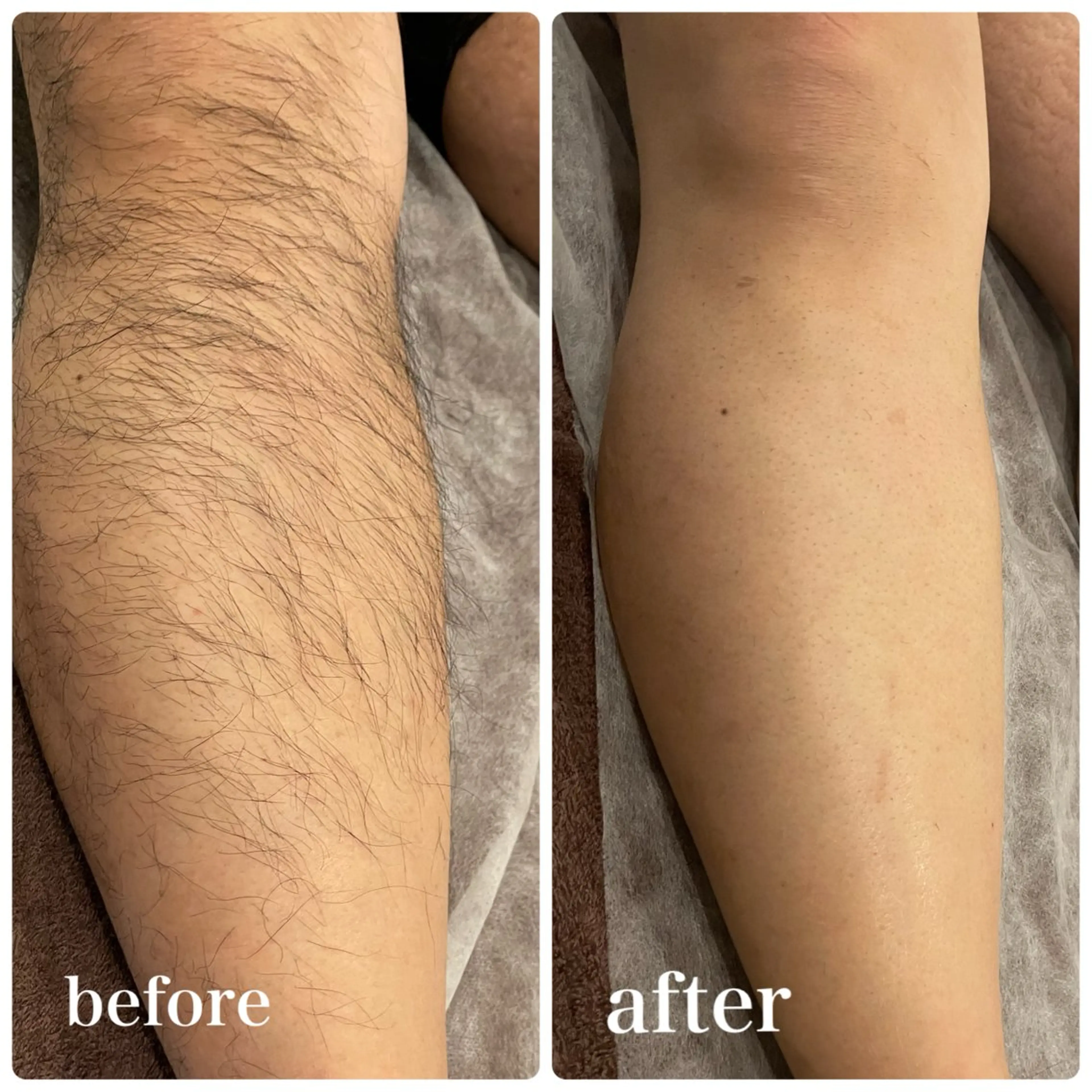 脱毛 脱毛専門サロンElixir加須店所属・脱毛専門サロン Elixir　加須店のエステ・リラクイメージ