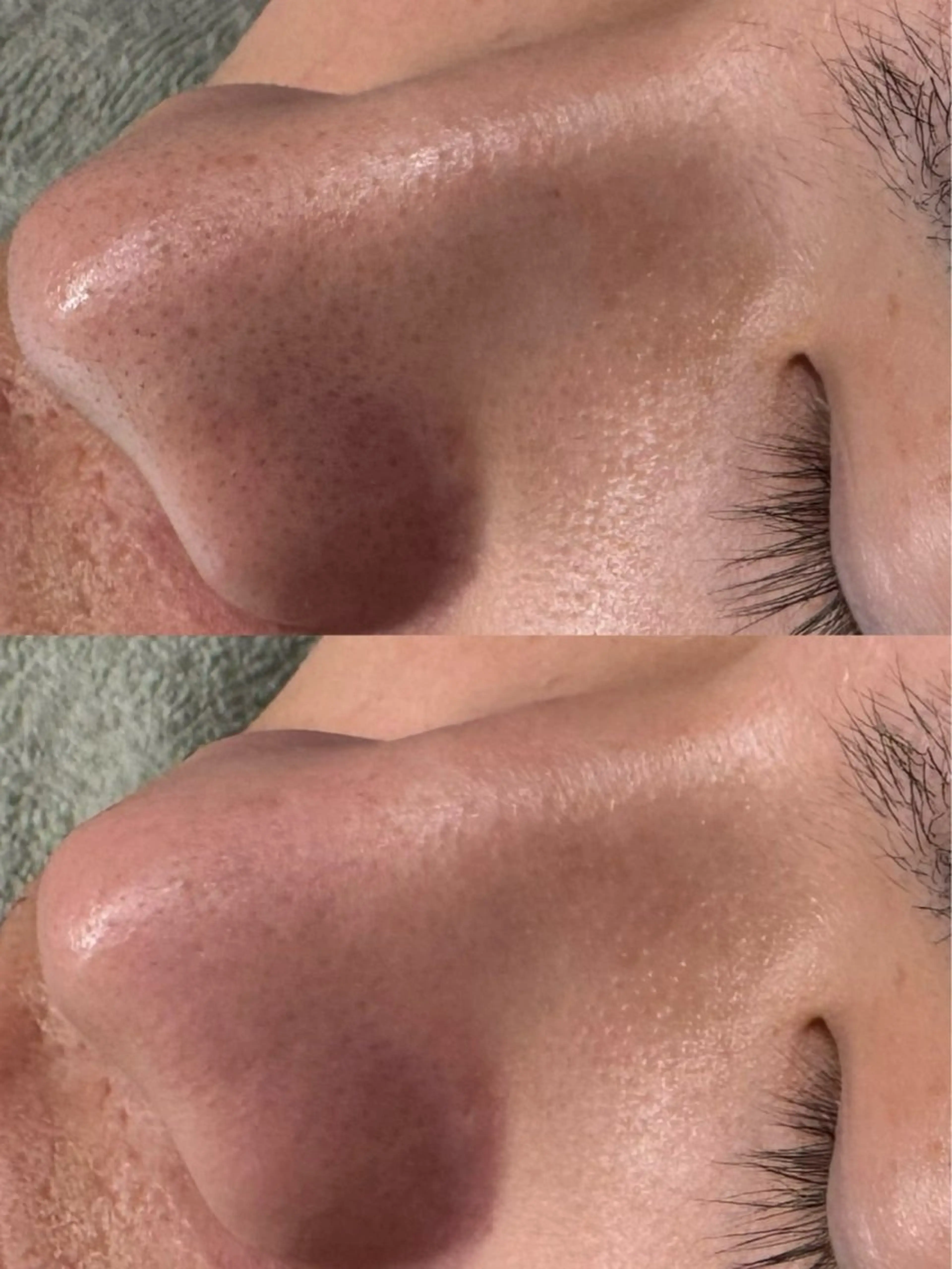 エステ 岩田 里央のエステ・リラクイメージ