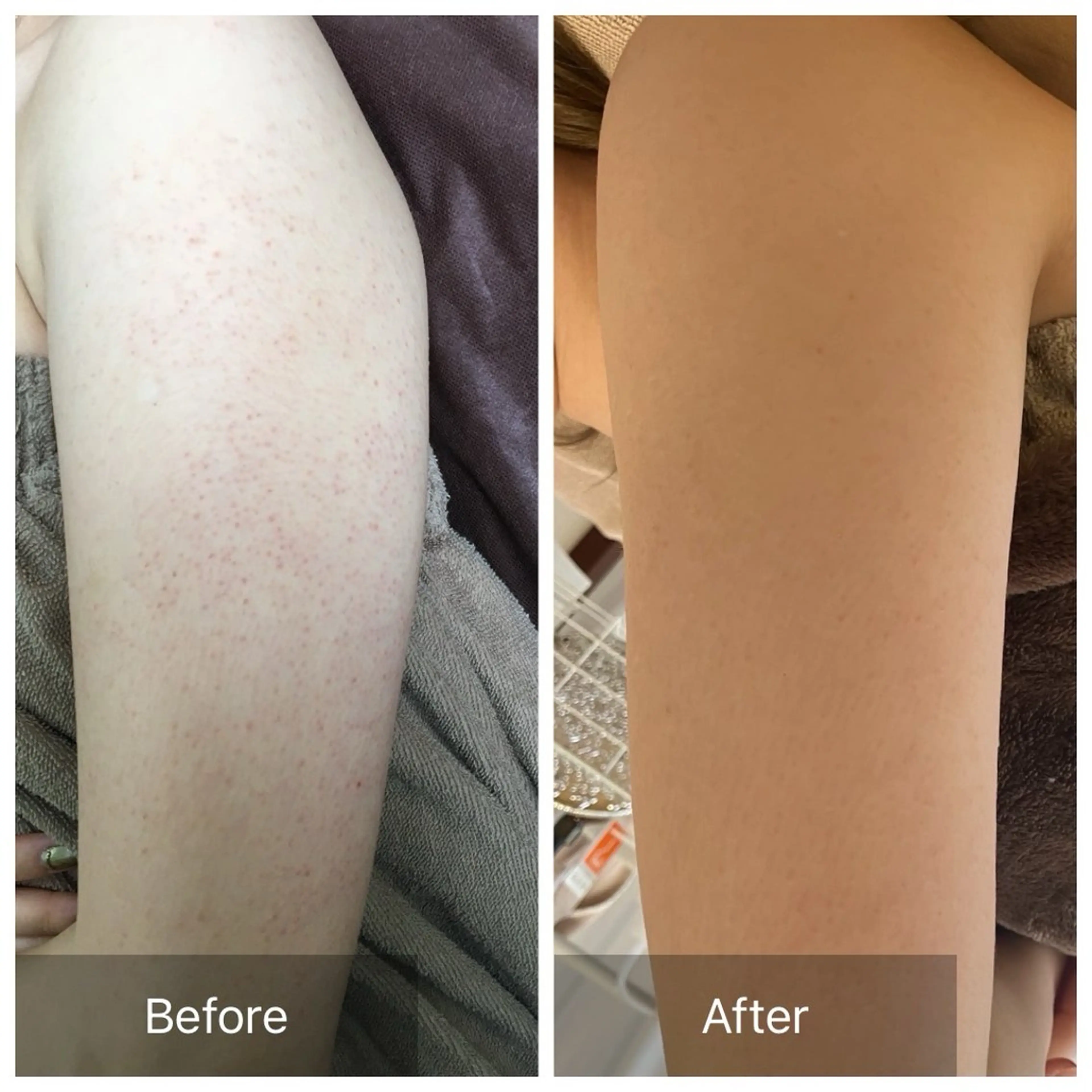 エステ ハーブピーリング 専門店MOKA所属・ハーブピーリング専門 MOKAのエステ・リラクイメージ