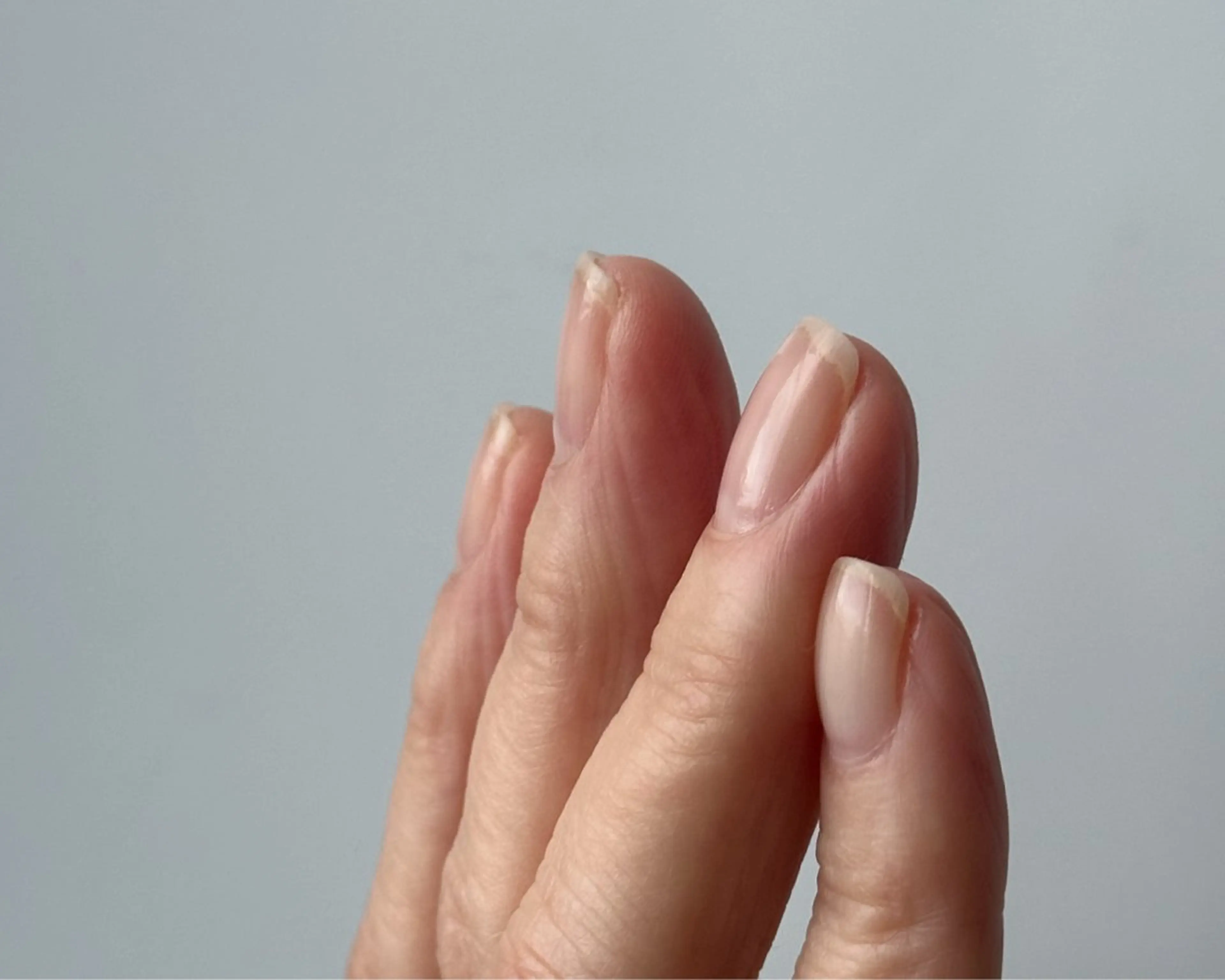 ネイル fote-自爪育成 ネイルケアサロン-のネイルデザイン