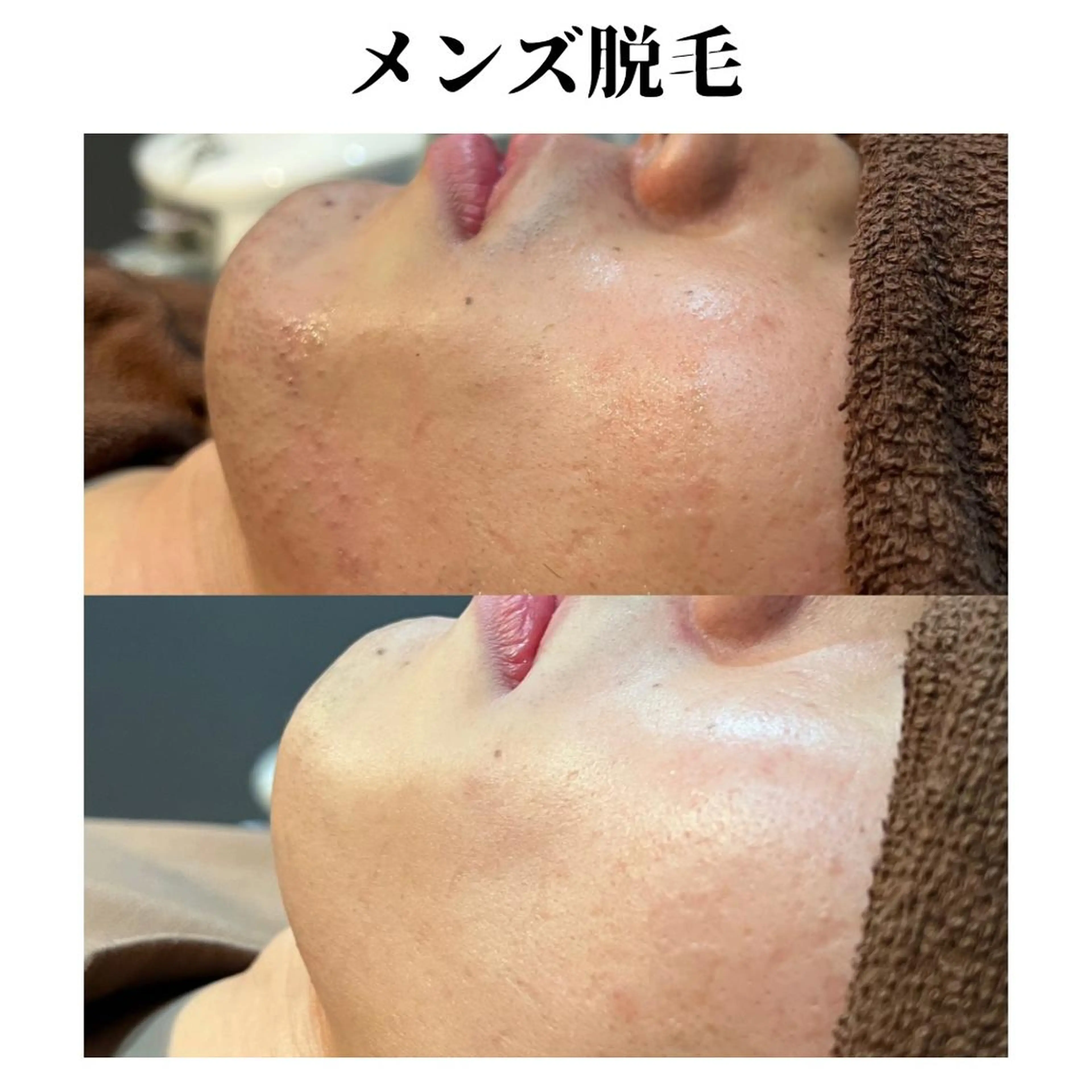 トータルビューティー サロンSalaのマツエク・マツパデザイン