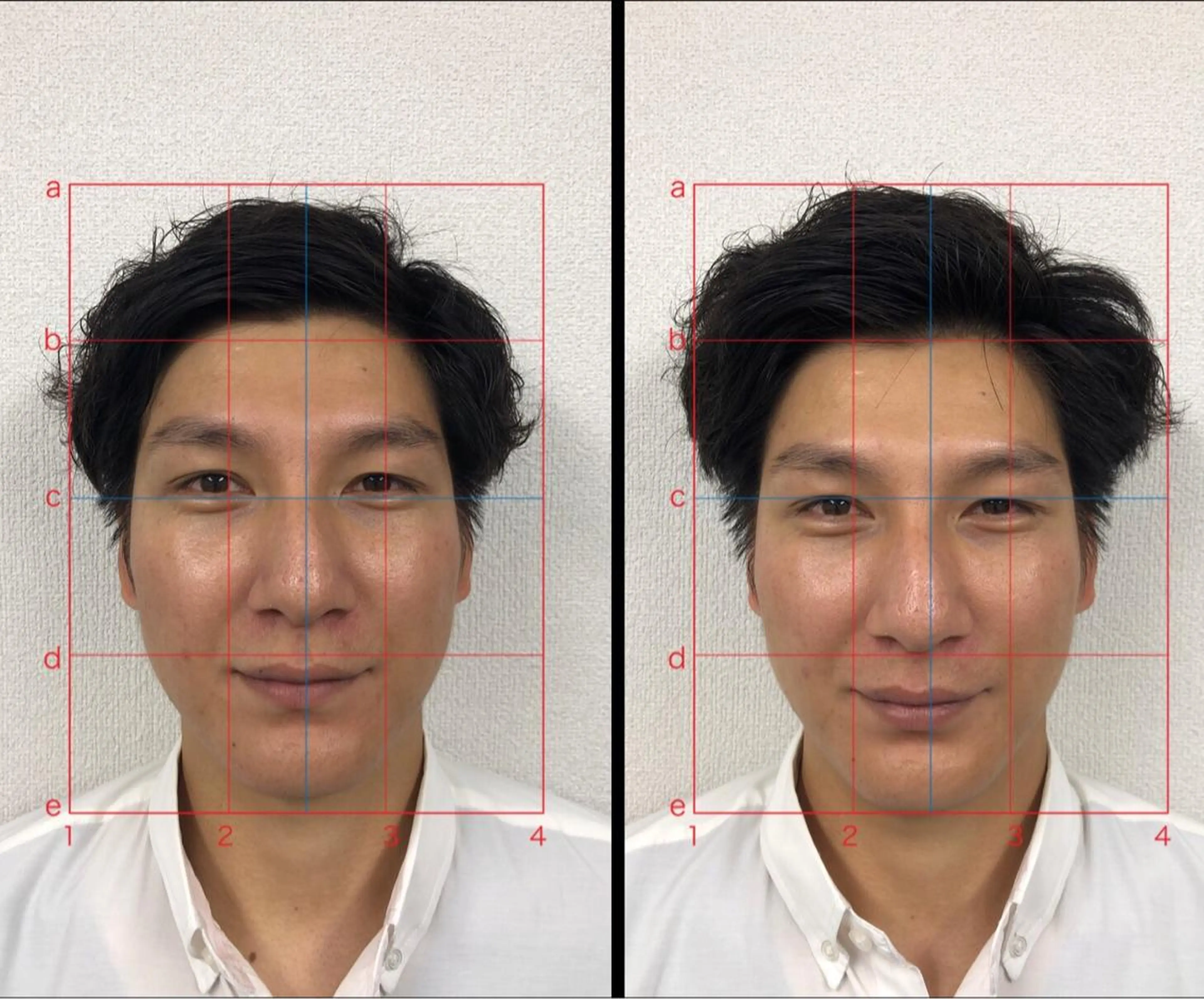 エステ リラク やはた 鍼灸整骨院のエステ・リラクイメージ