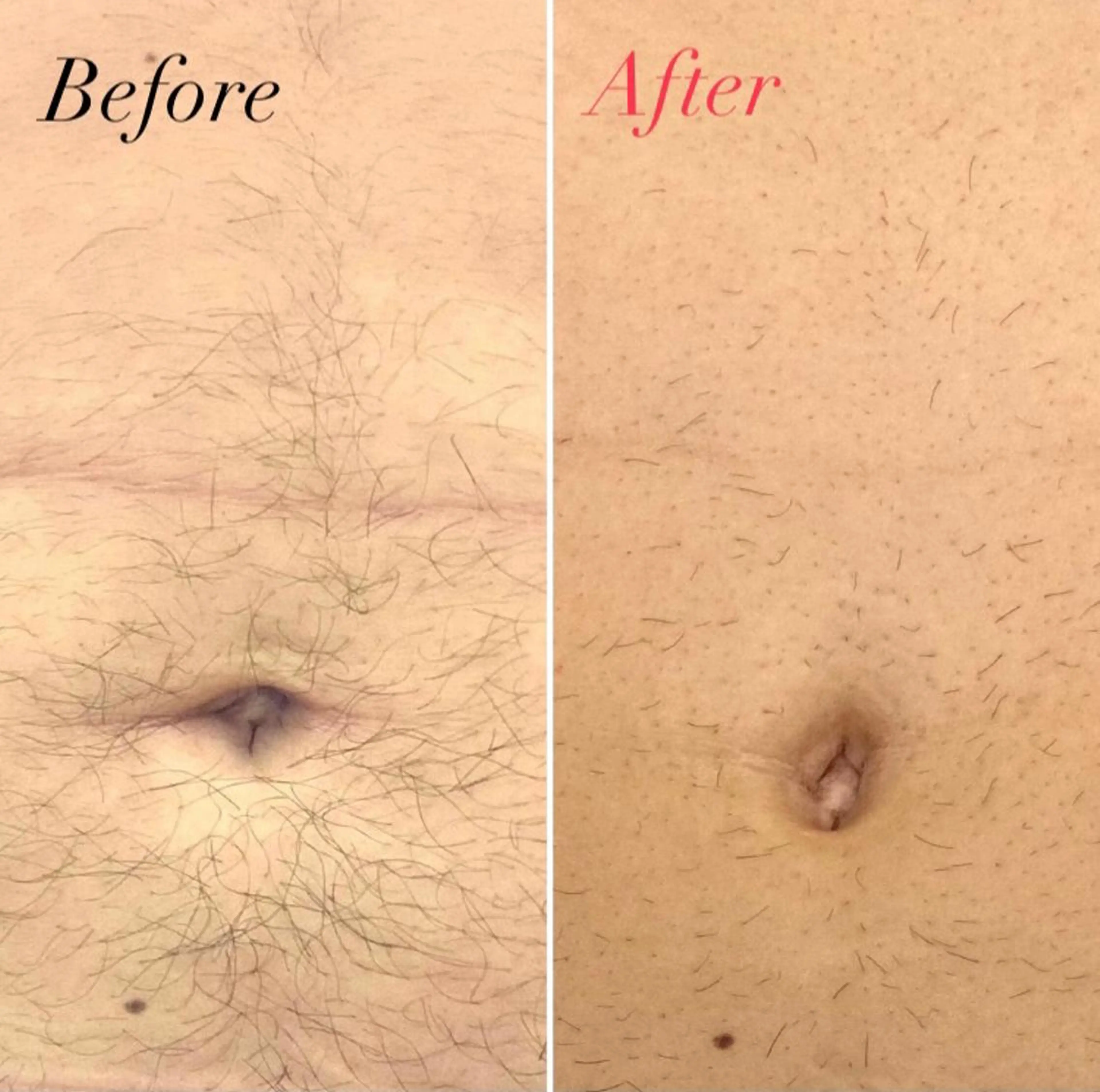 脱毛サロン Lilのエステ・リラクイメージ