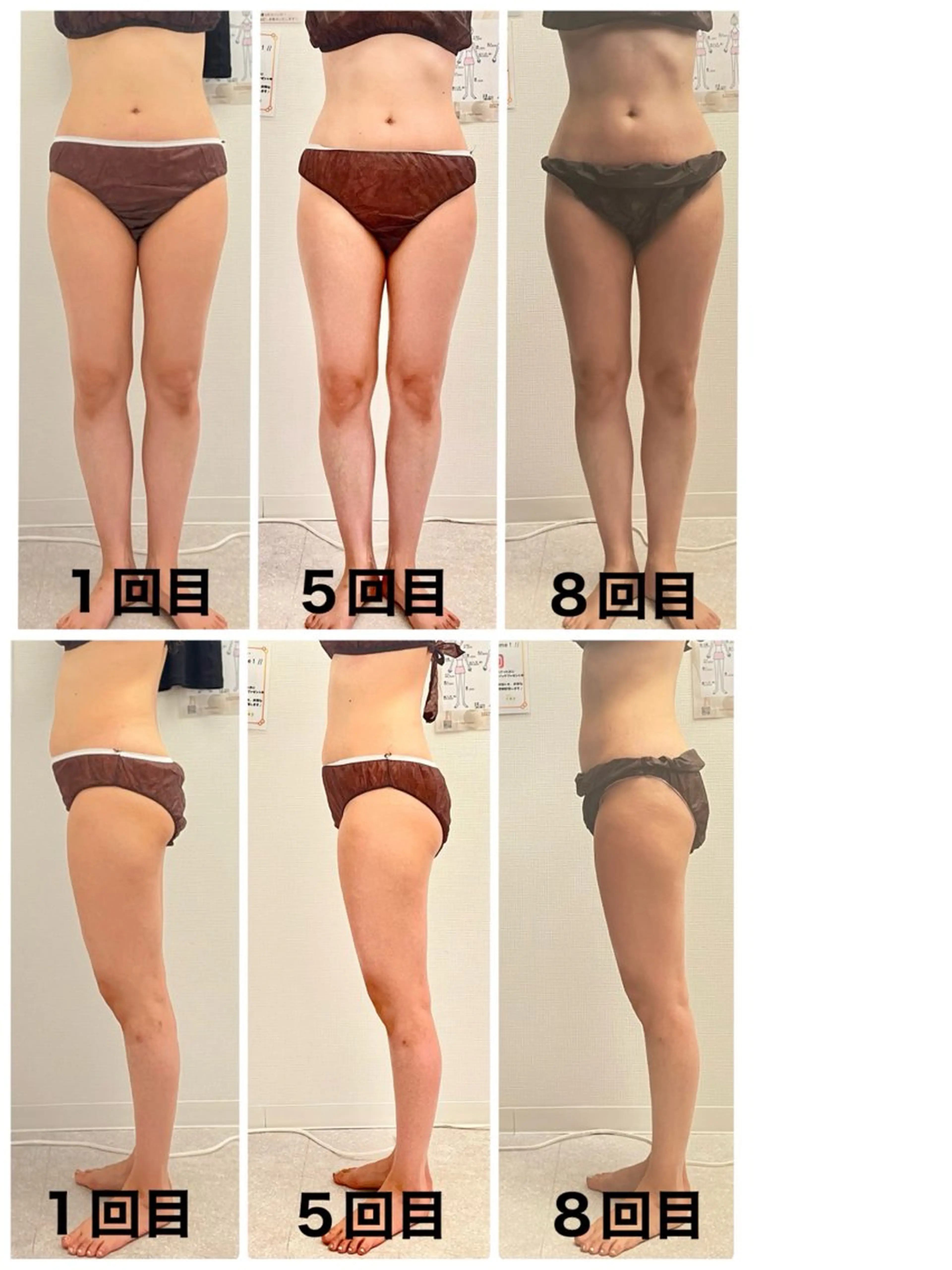 その他 salon ray 痩身／体質改善のエステ・リラクイメージ