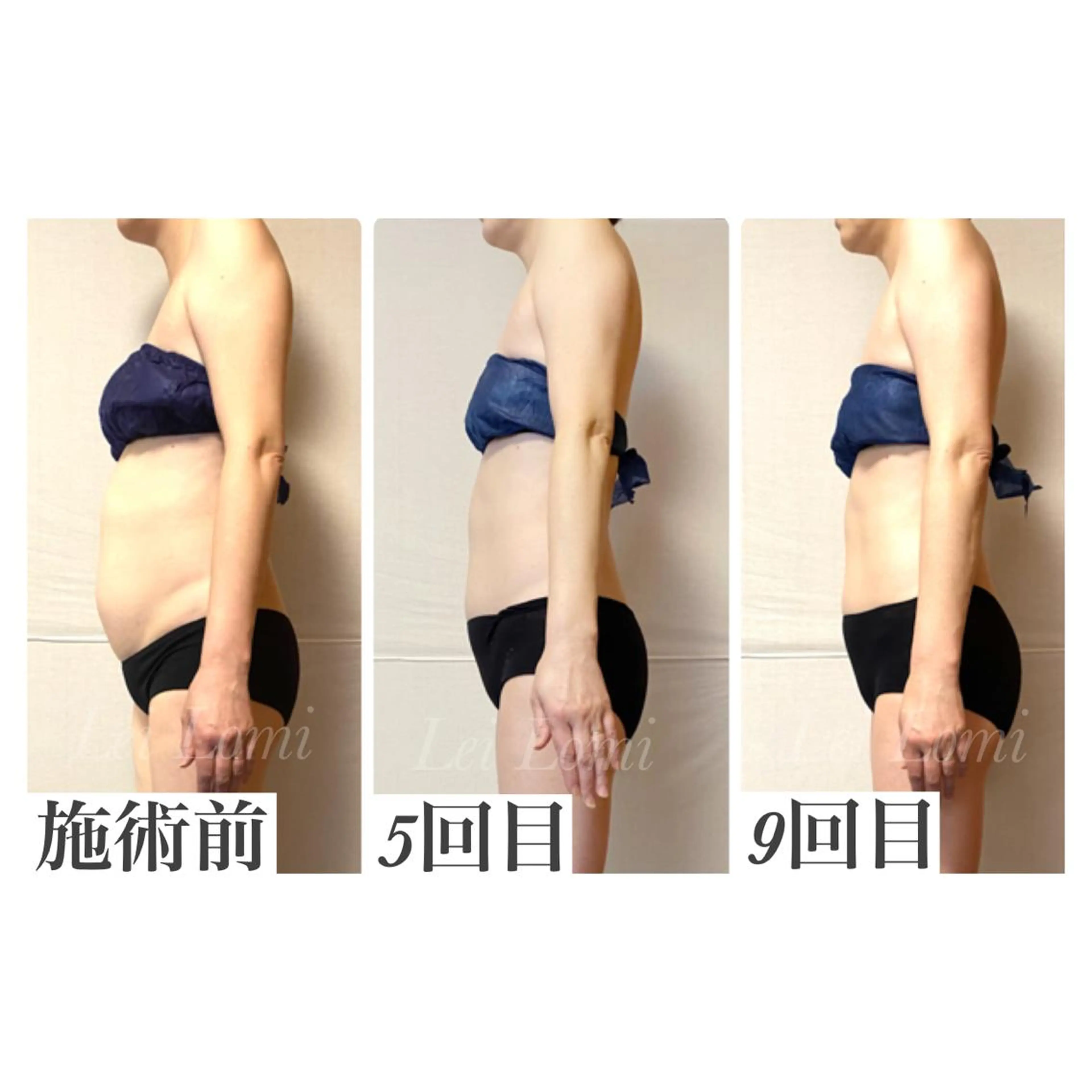 エステ 痩身＆ヘッド 長倉絵美のエステ・リラクイメージ