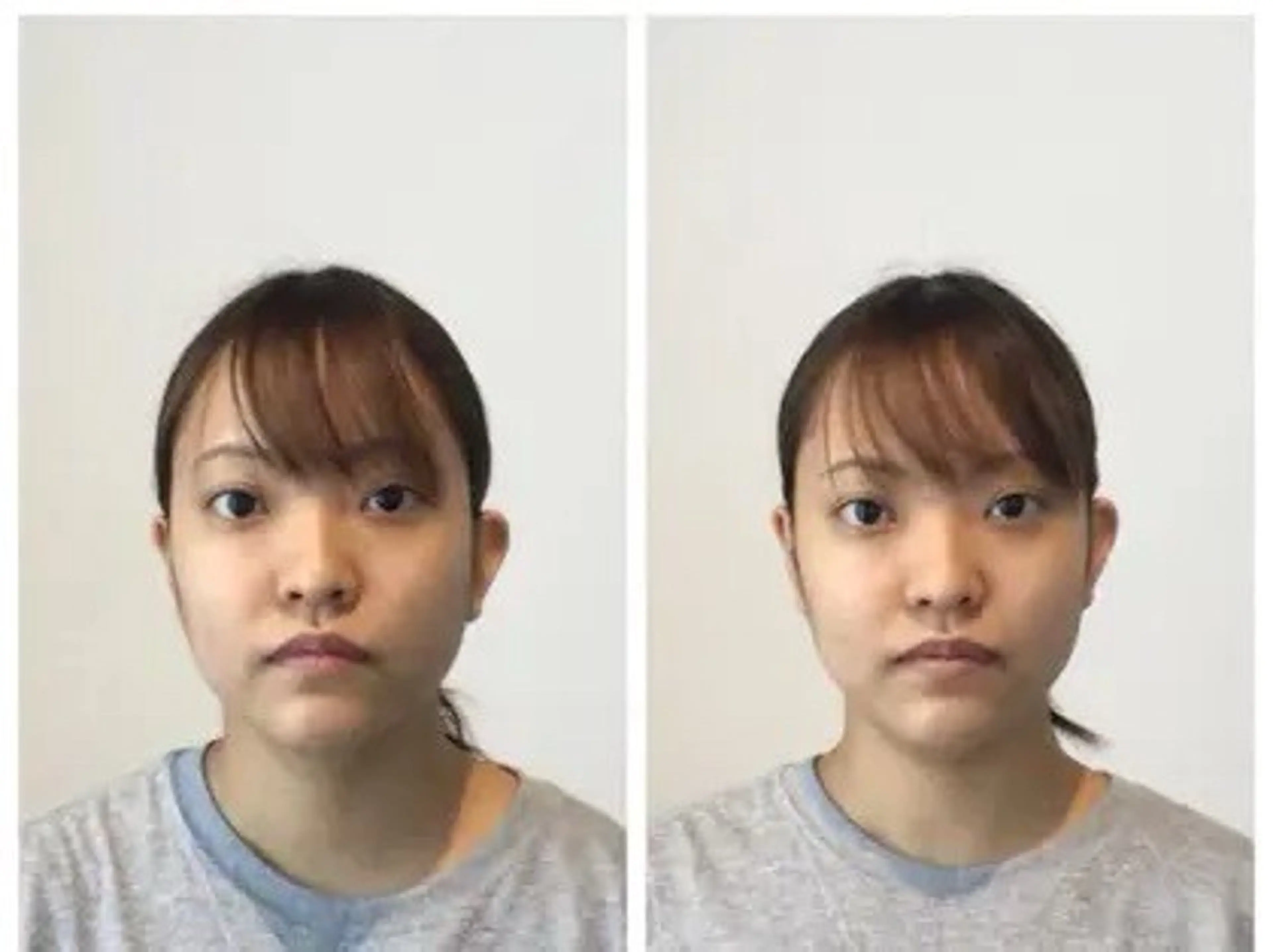 美容整体プラスフィール、錦糸町店所属・錦糸町美容整体 プラスフィール 小山のエステ・リラクイメージ