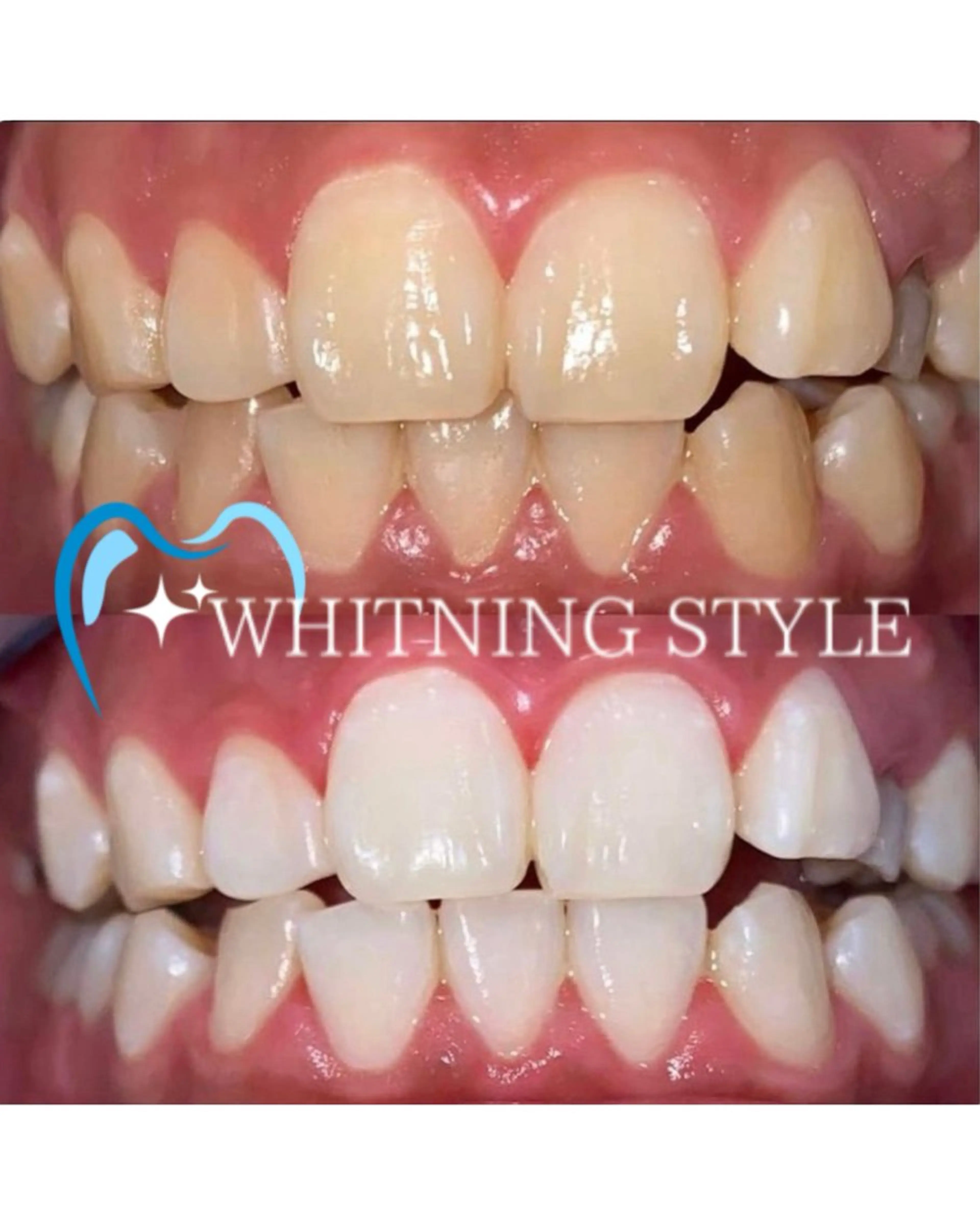 【歯科提携】柏ホワイ トニングスタイルのその他イメージ