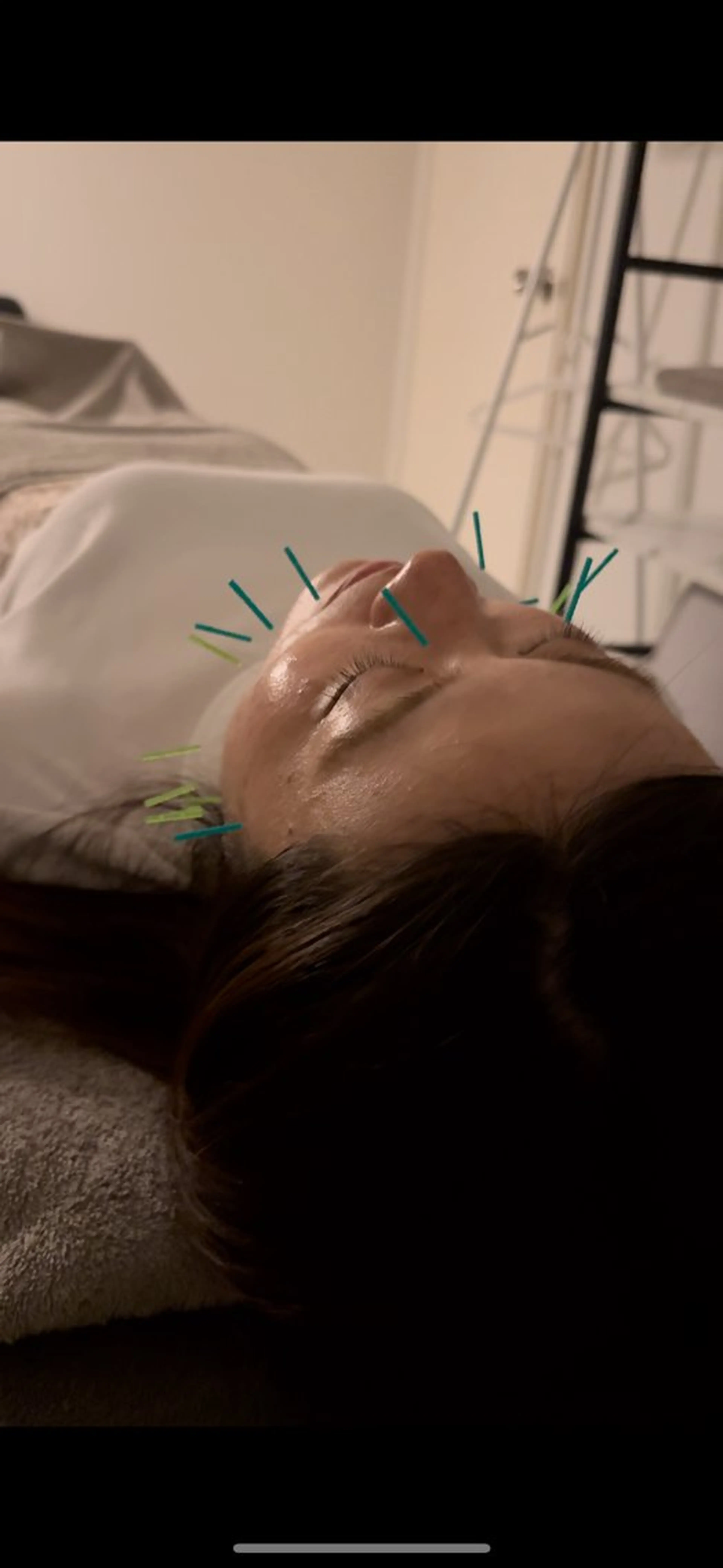 エステ 美容鍼×小顔矯正 ×美容整体 浜川泰仁のエステ・リラクイメージ