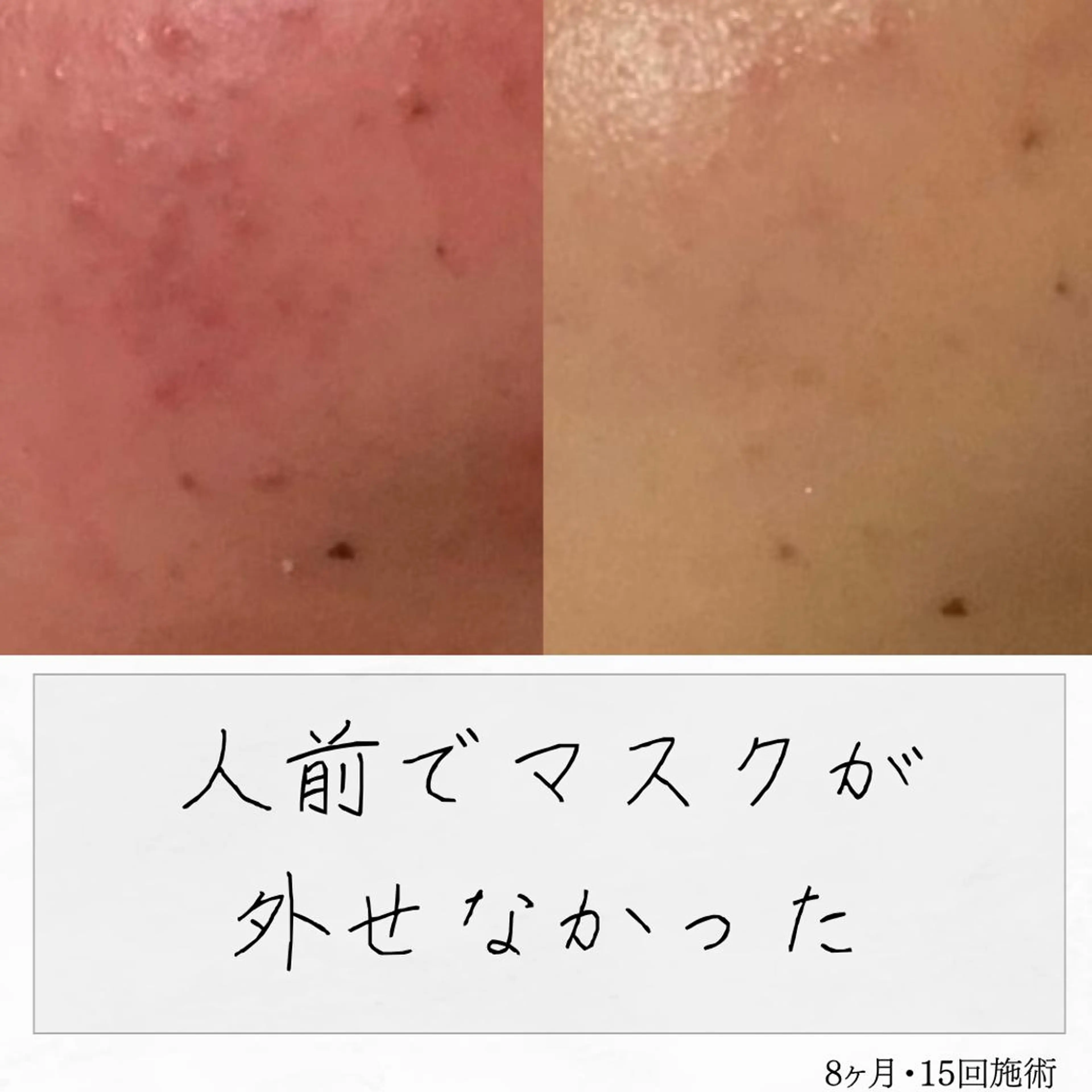 ニキビ経験者が施術 する専門サロン🌻のエステ・リラクイメージ